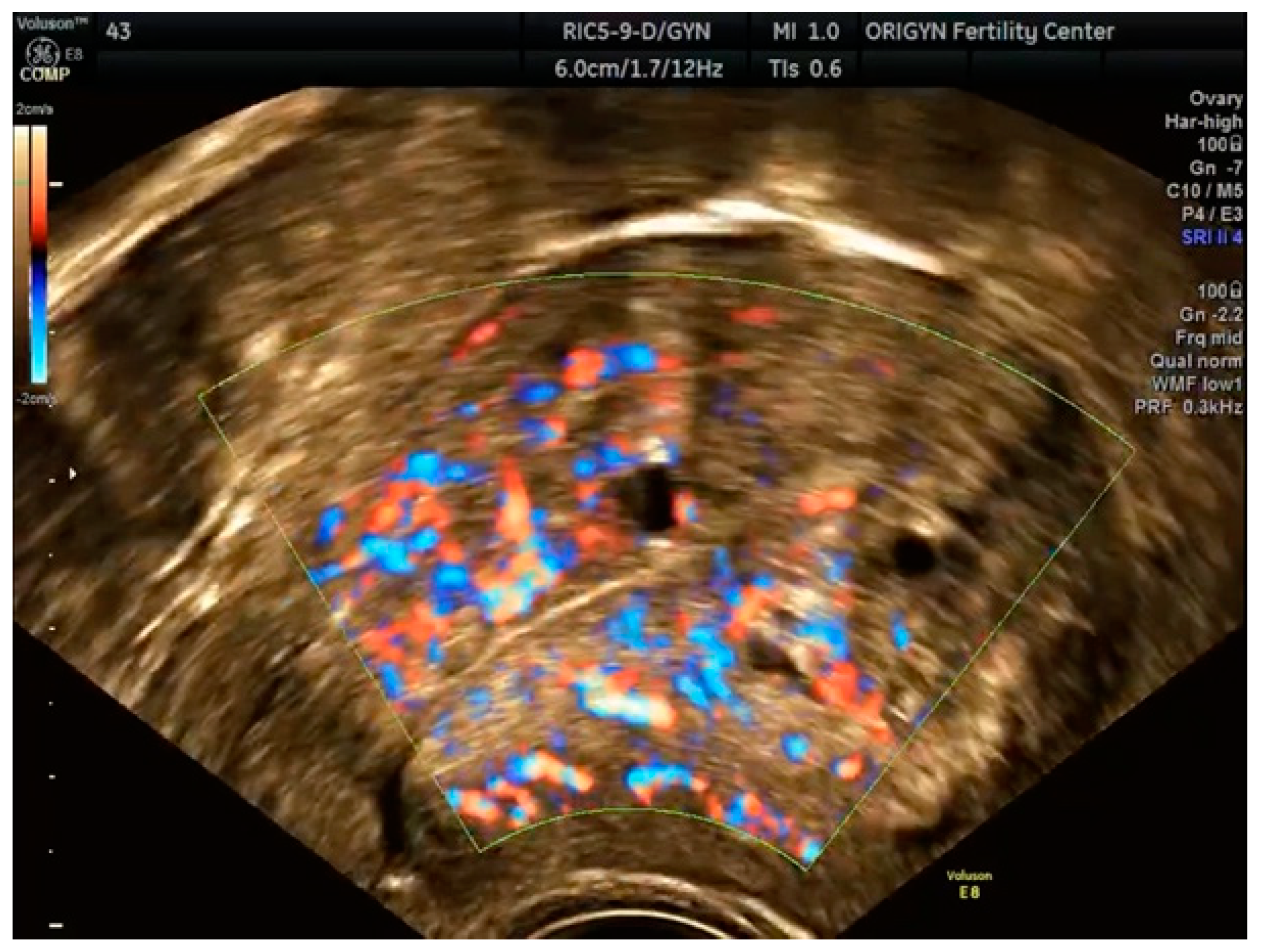 Diagnostics 11 00444 g008 Diagnostics 11 00444 g008