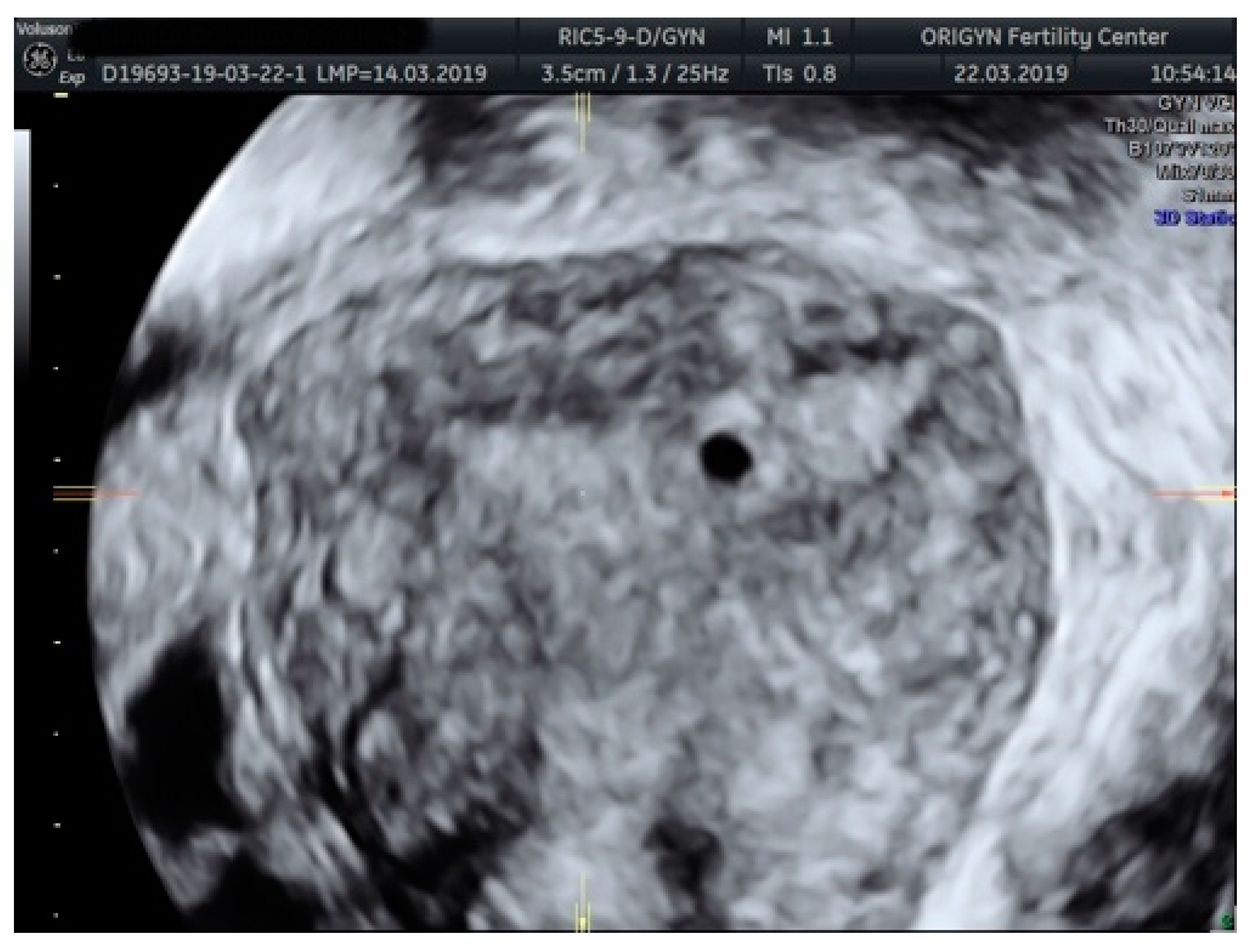 Diagnostics 11 00444 g009 Diagnostics 11 00444 g009