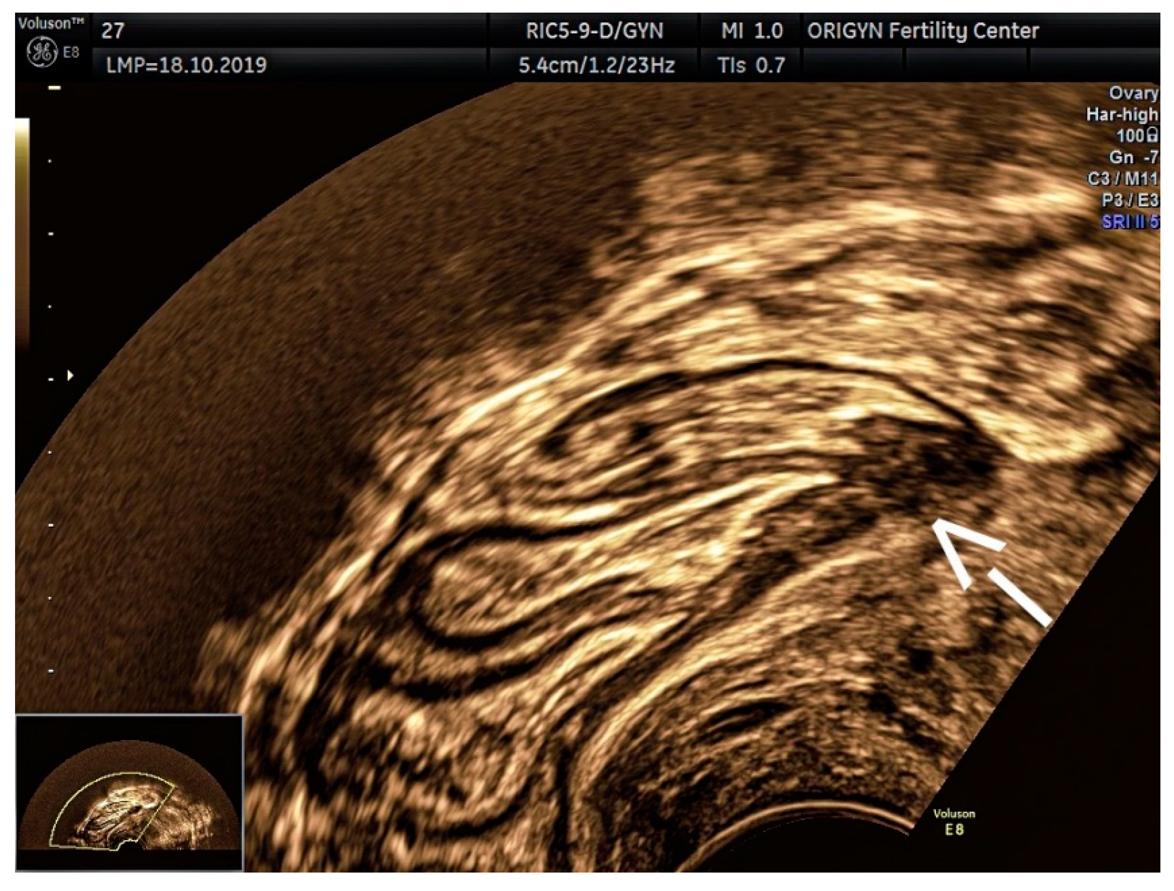 Diagnostics 11 00444 g011 Diagnostics 11 00444 g011