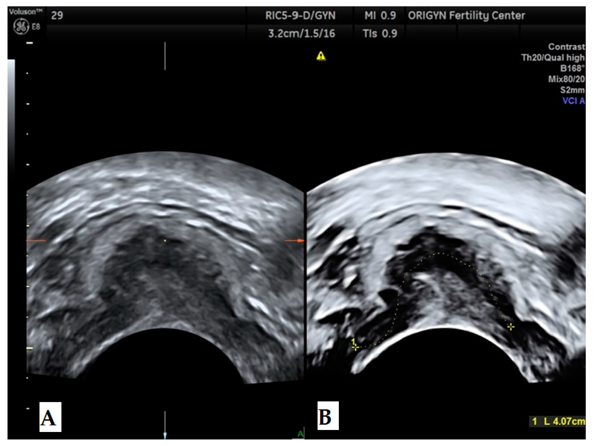 Diagnostics 11 00444 g012 Diagnostics 11 00444 g012