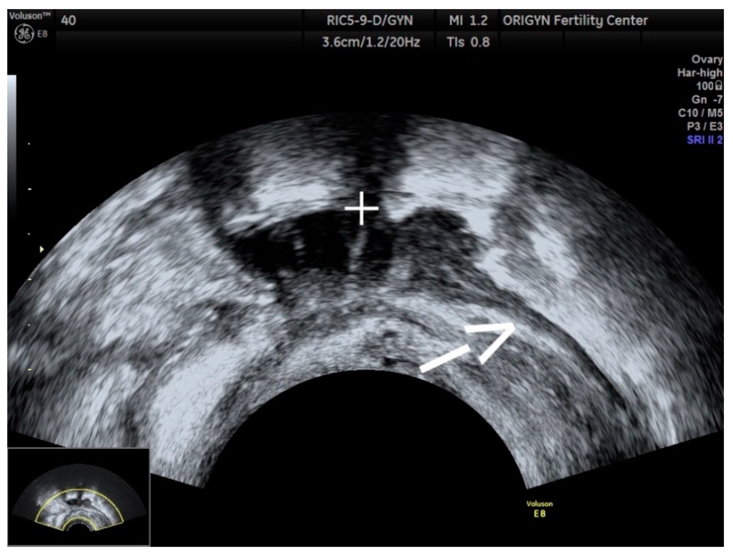 Diagnostics 11 00444 g013 Diagnostics 11 00444 g013