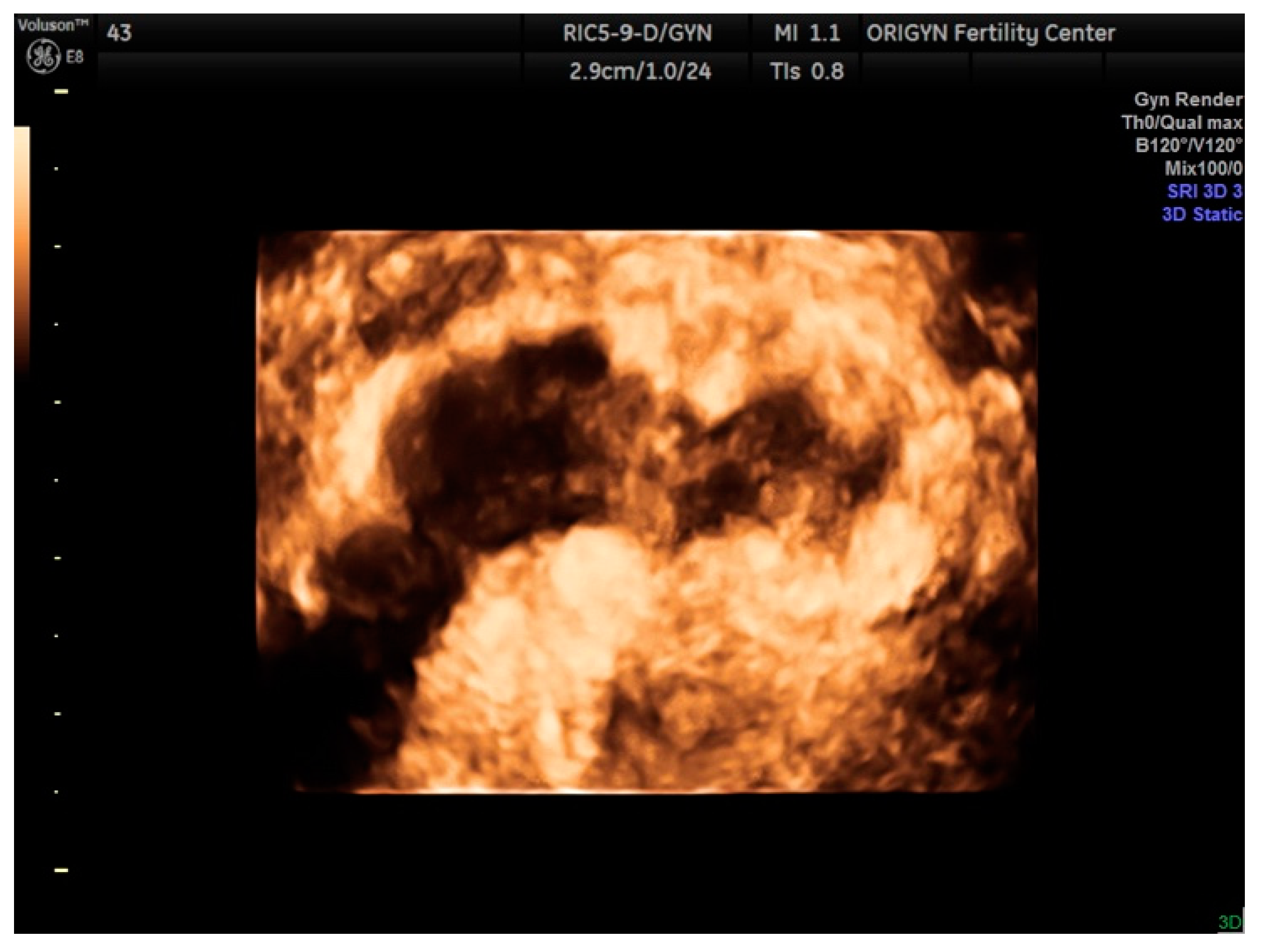 Diagnostics 11 00444 g016 Diagnostics 11 00444 g016