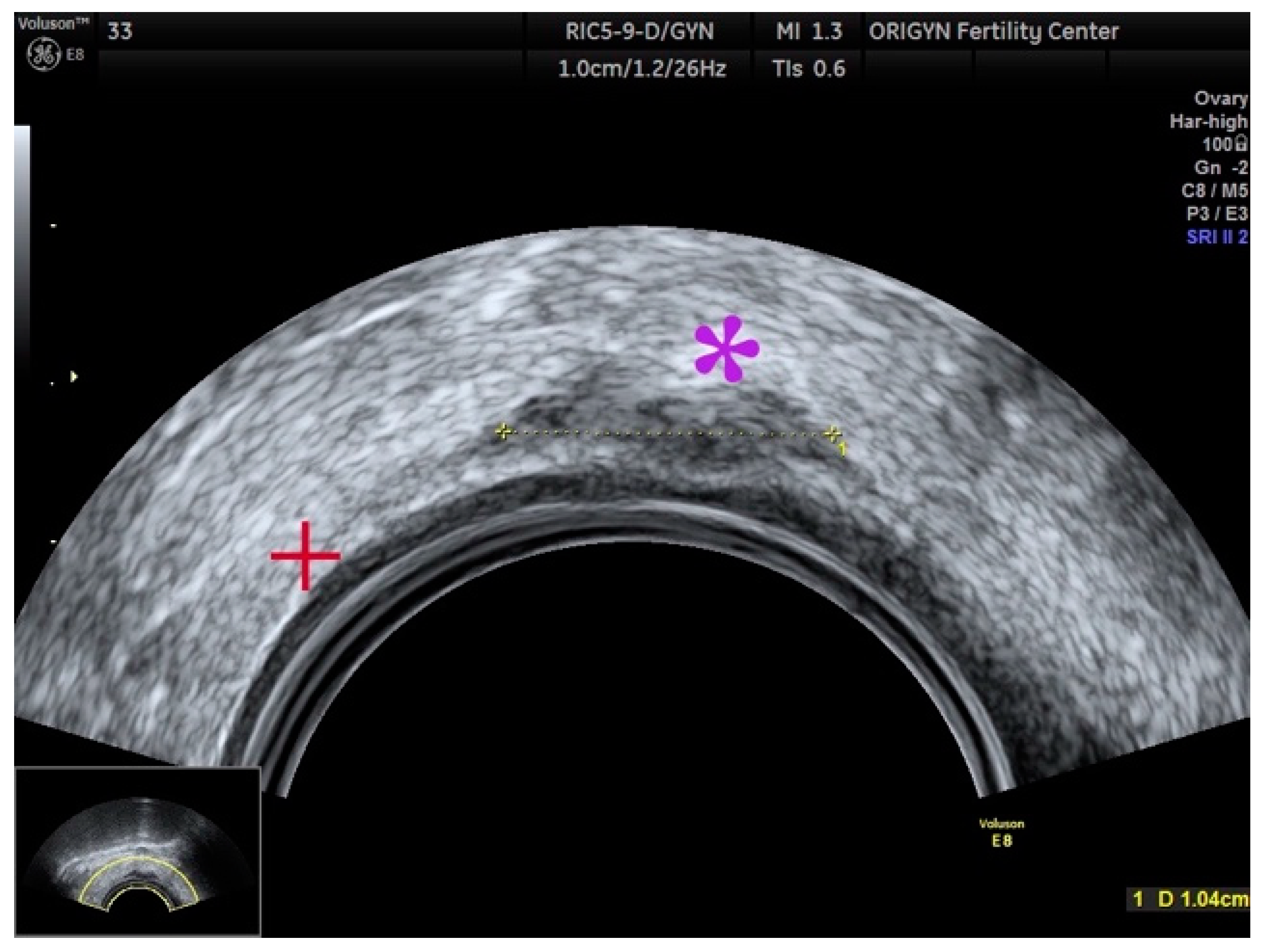 Diagnostics 11 00444 g017 Diagnostics 11 00444 g017