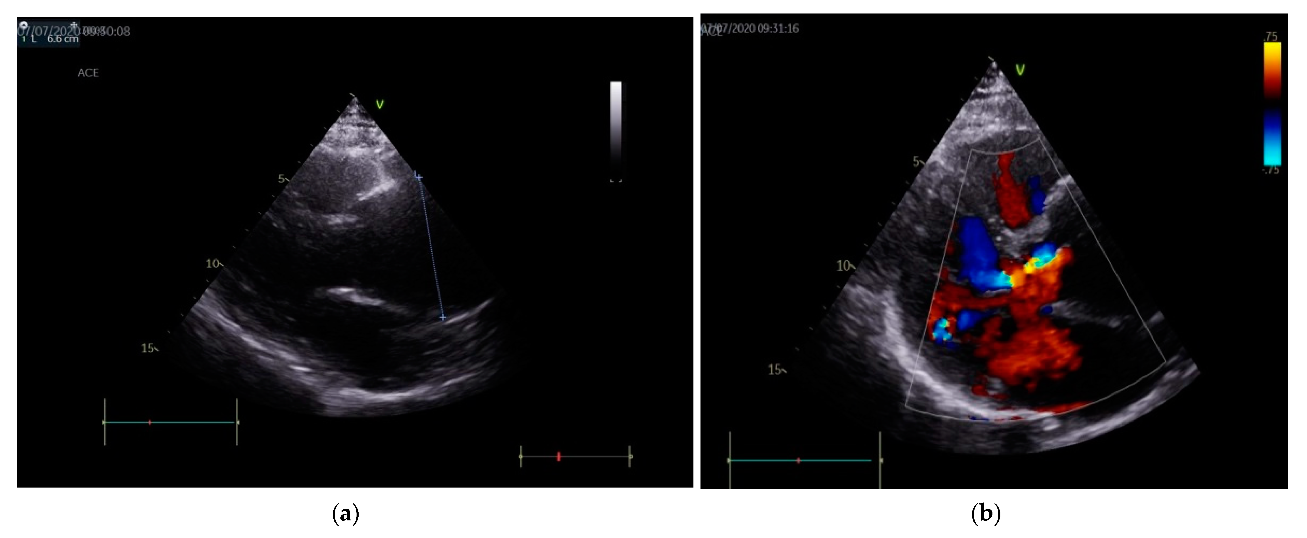 Diagnostics 11 00446 g001