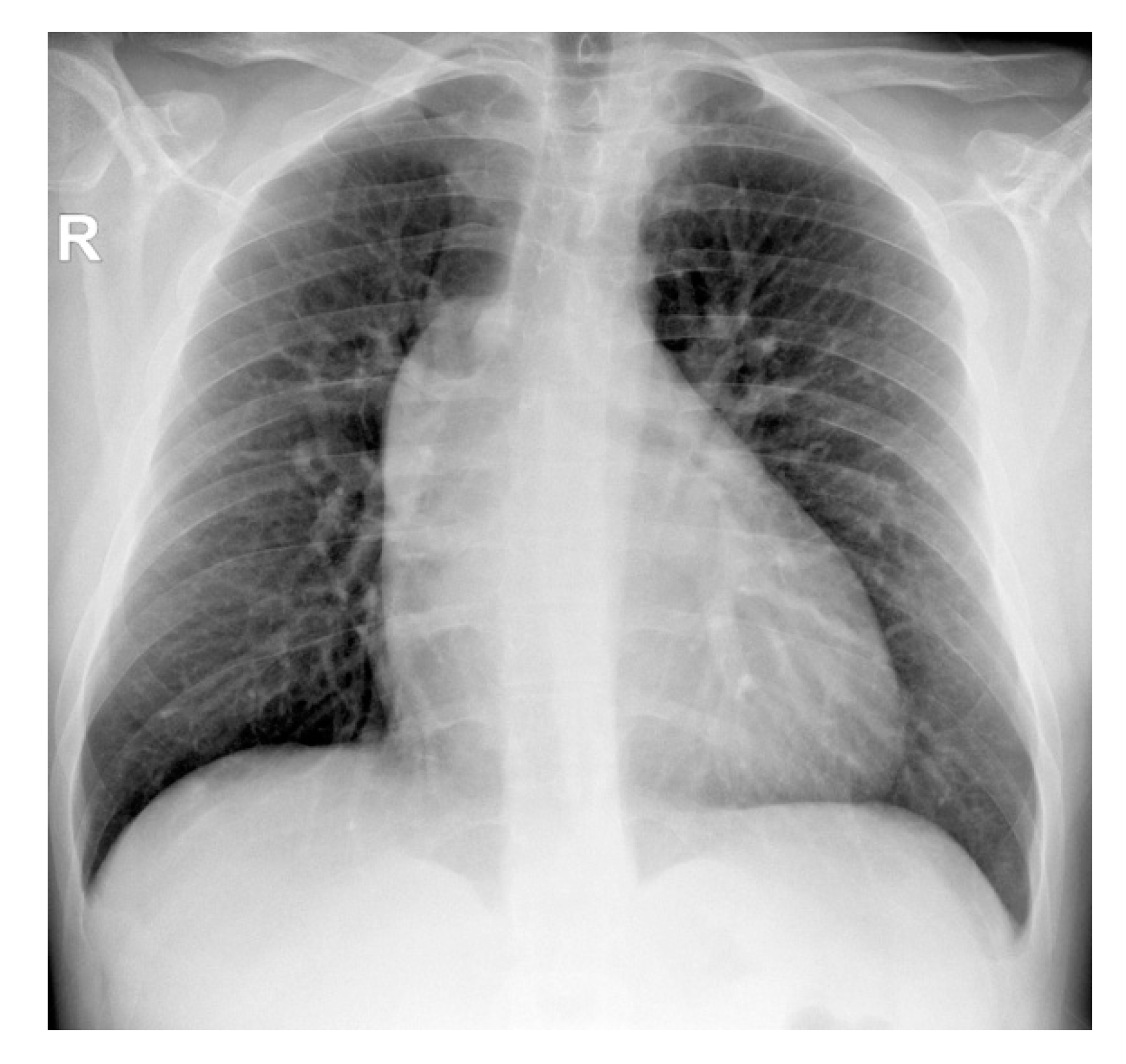 Diagnostics 11 00446 g002