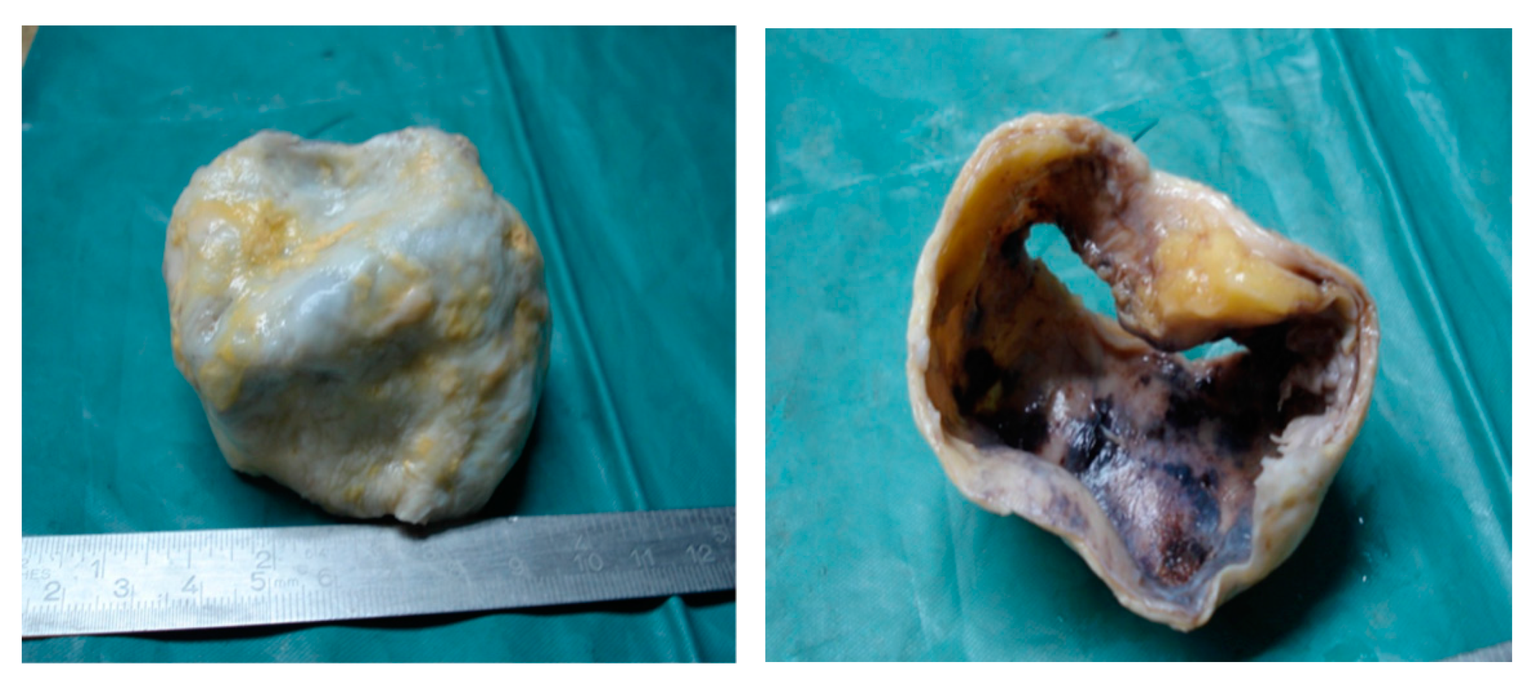 Diagnostics 11 00446 g004