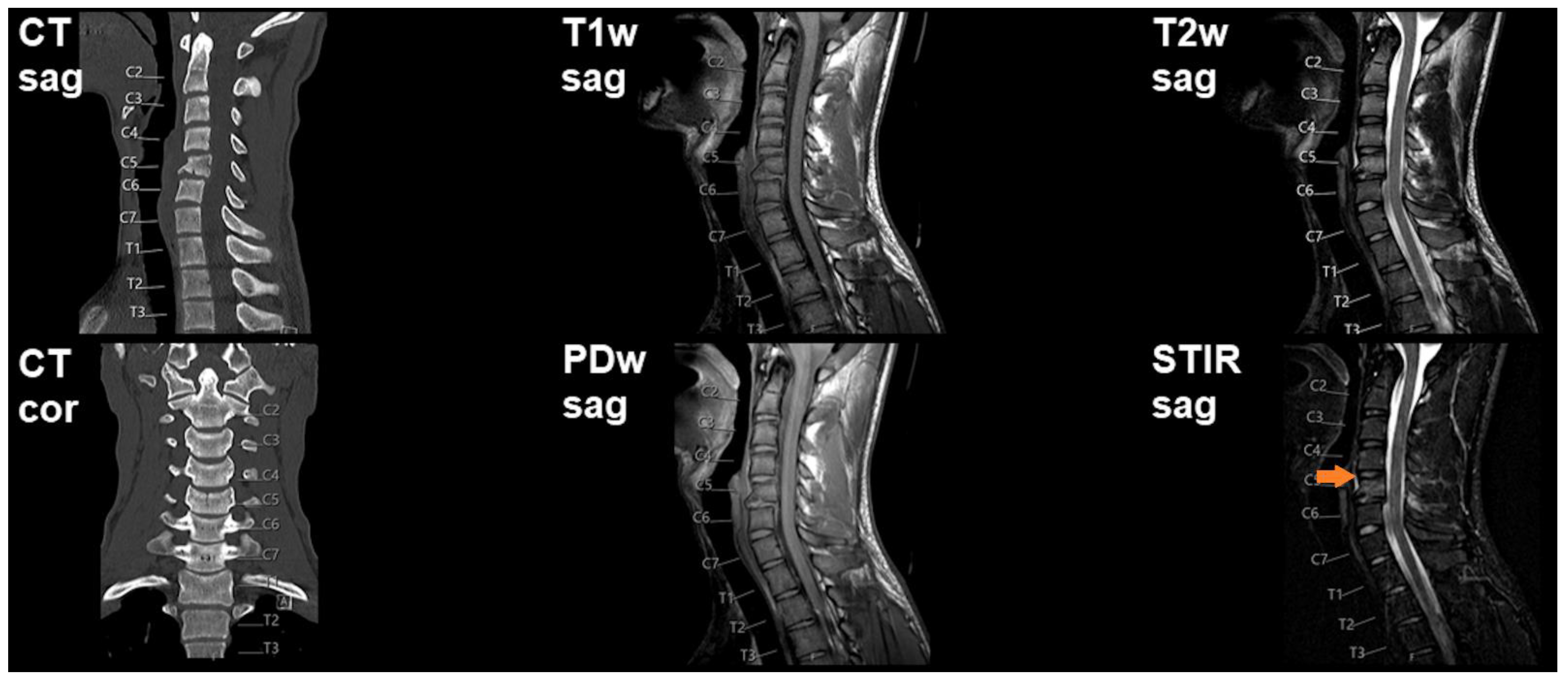 Diagnostics 11 00447 g003