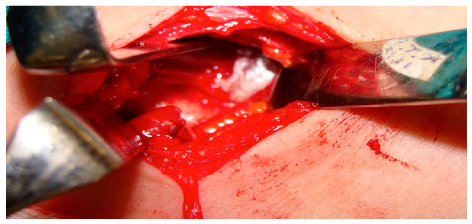 Diagnostics 11 00450 g003 Diagnostics 11 00450 g003