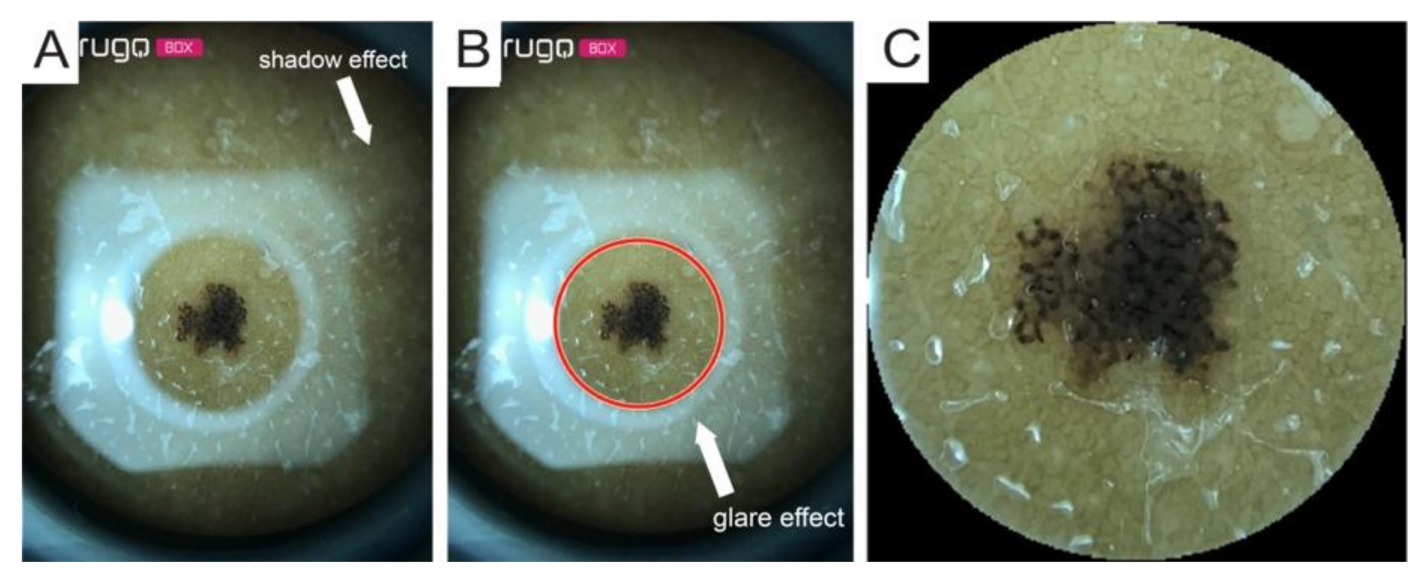 Diagnostics 11 00451 g003 Diagnostics 11 00451 g003