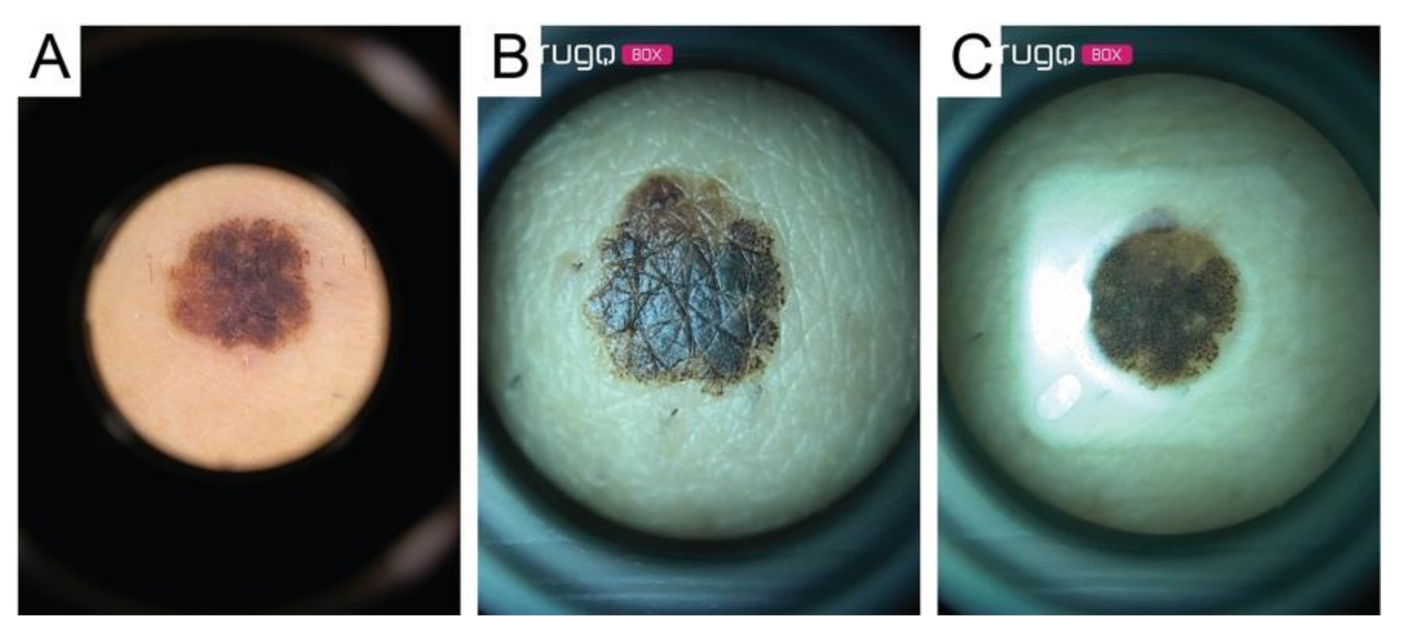 Diagnostics 11 00451 g004 Diagnostics 11 00451 g004