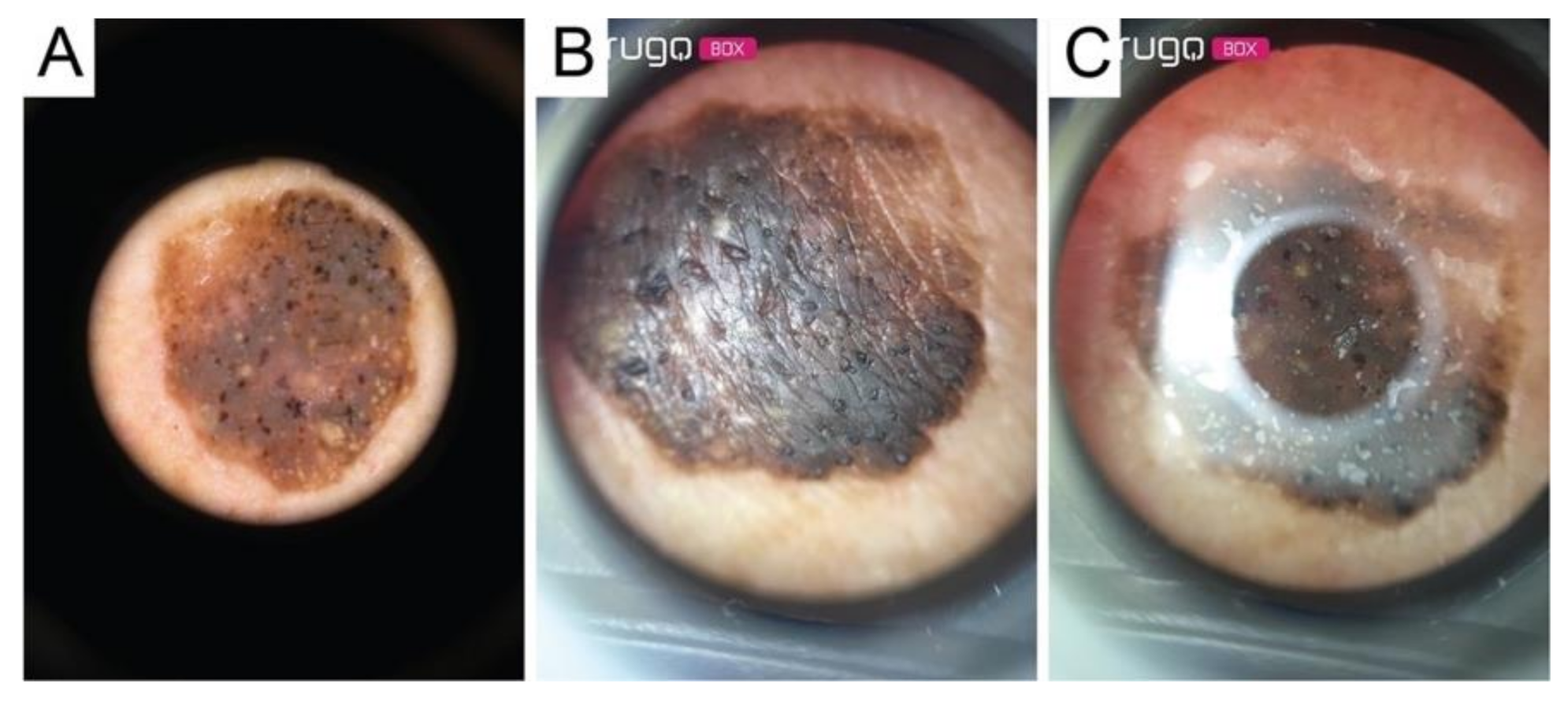 Diagnostics 11 00451 g006 Diagnostics 11 00451 g006