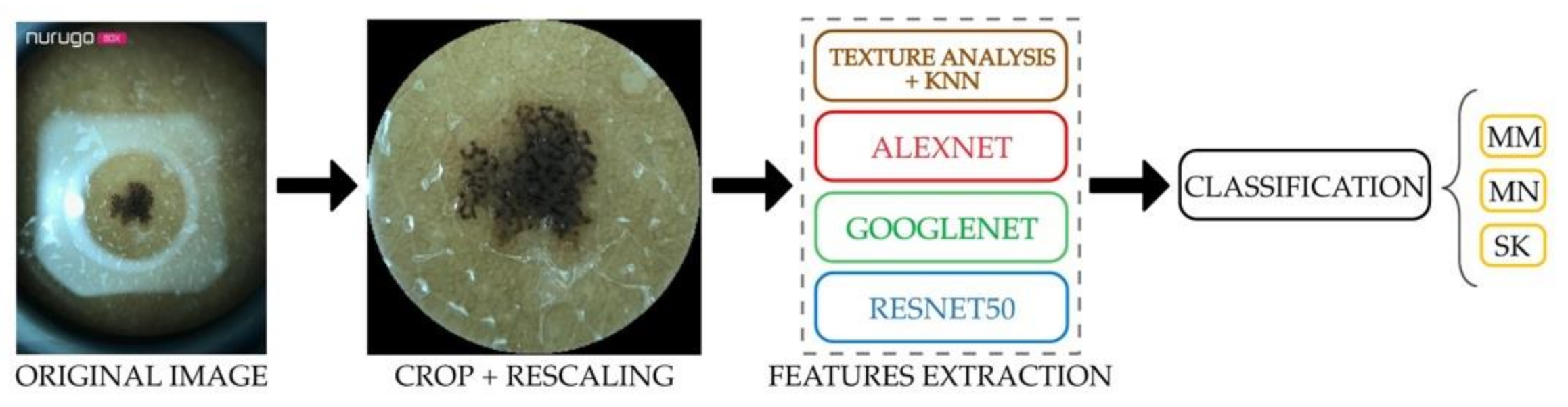 Diagnostics 11 00451 g008 Diagnostics 11 00451 g008