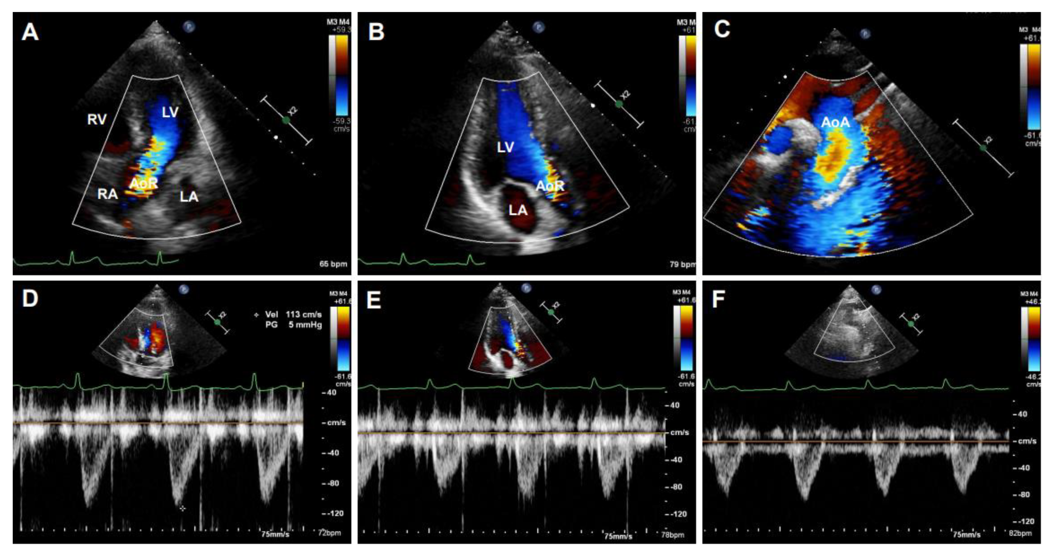Diagnostics 11 00454 g005