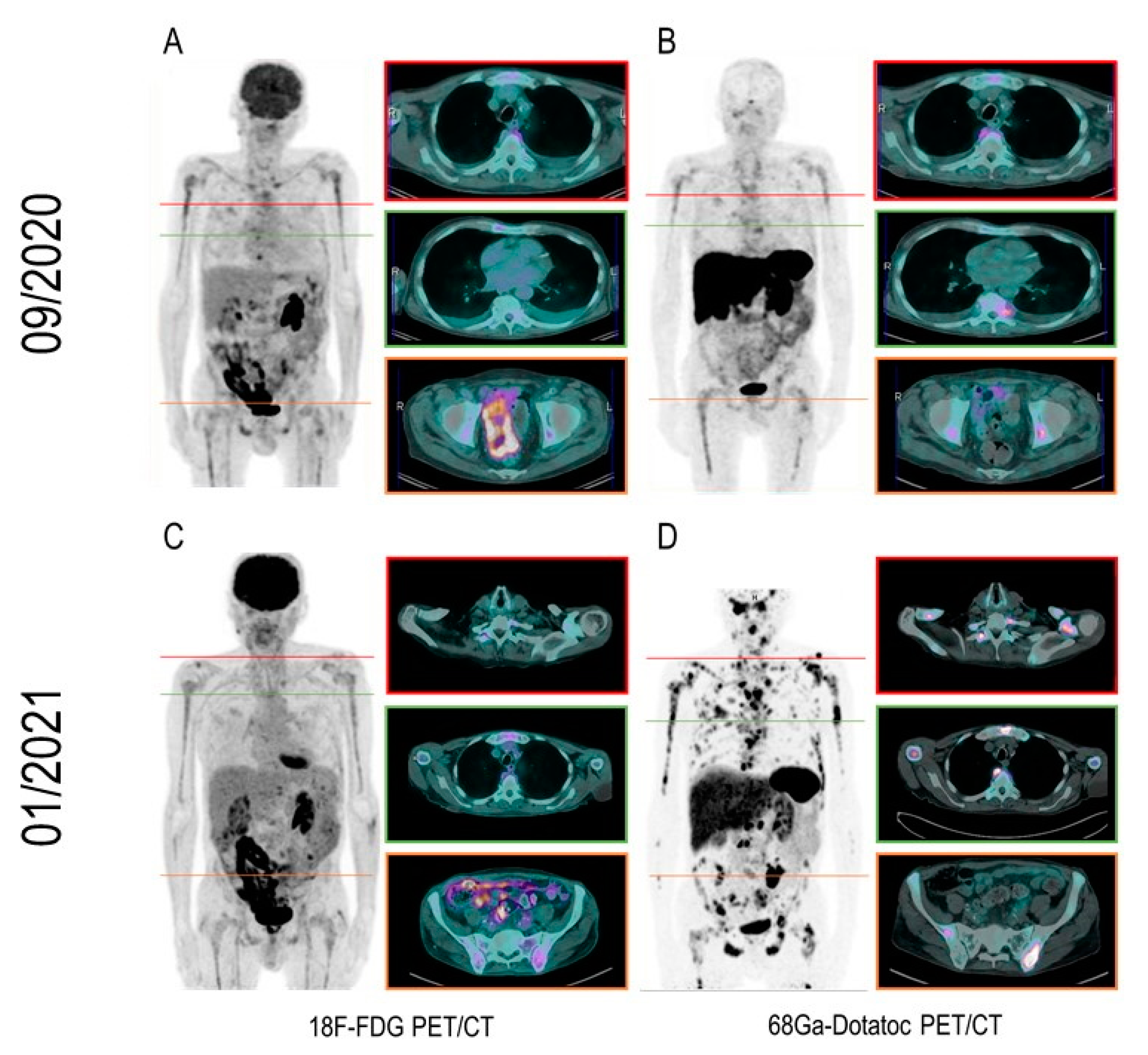 Diagnostics 11 00468 g001 Diagnostics 11 00468 g001