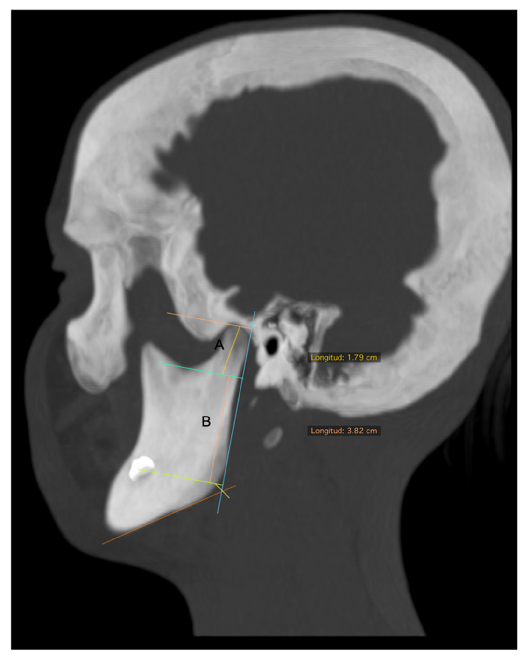 Diagnostics 11 00477 g002 Diagnostics 11 00477 g002