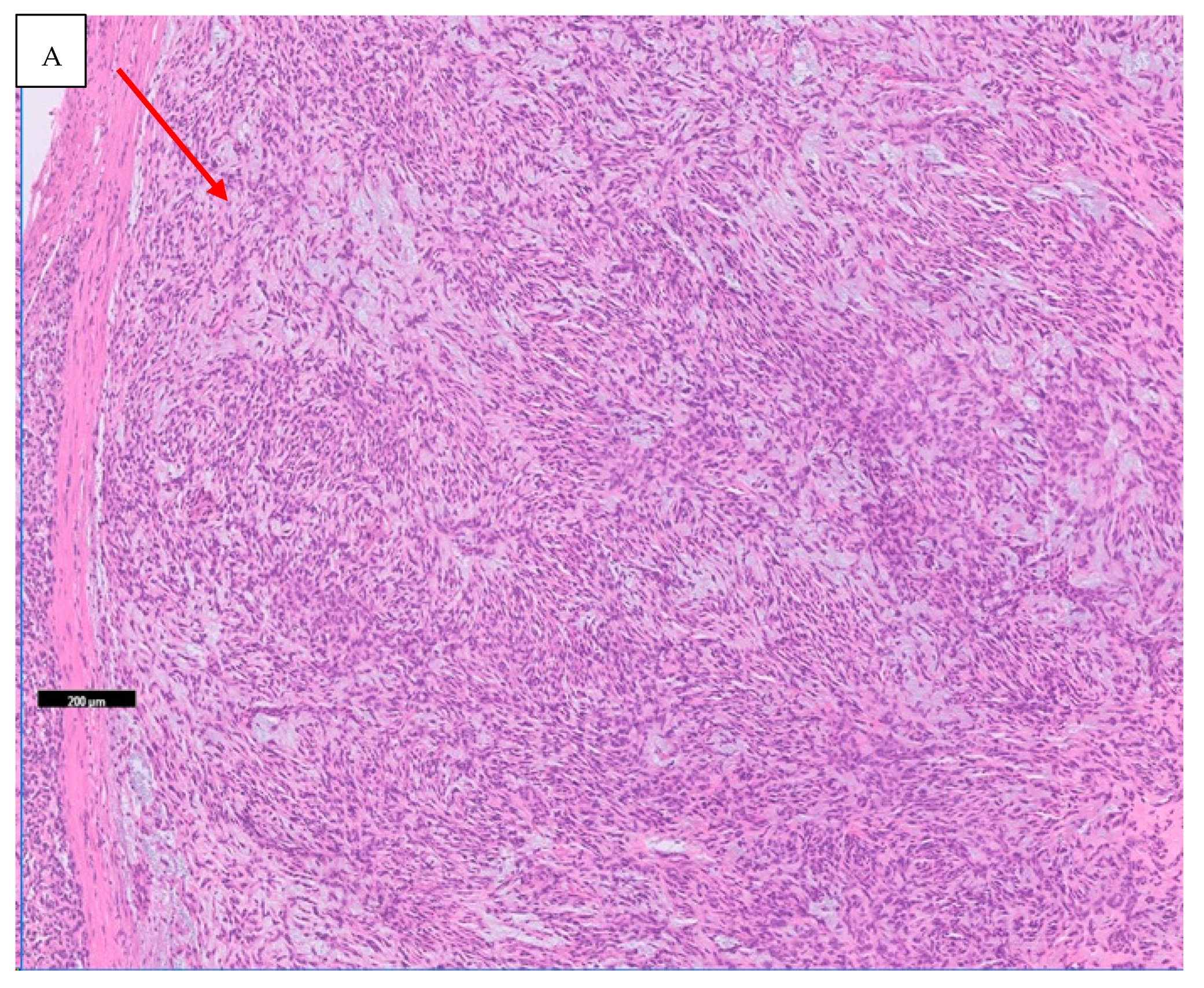 Diagnostics 11 00478 g001a Diagnostics 11 00478 g001a