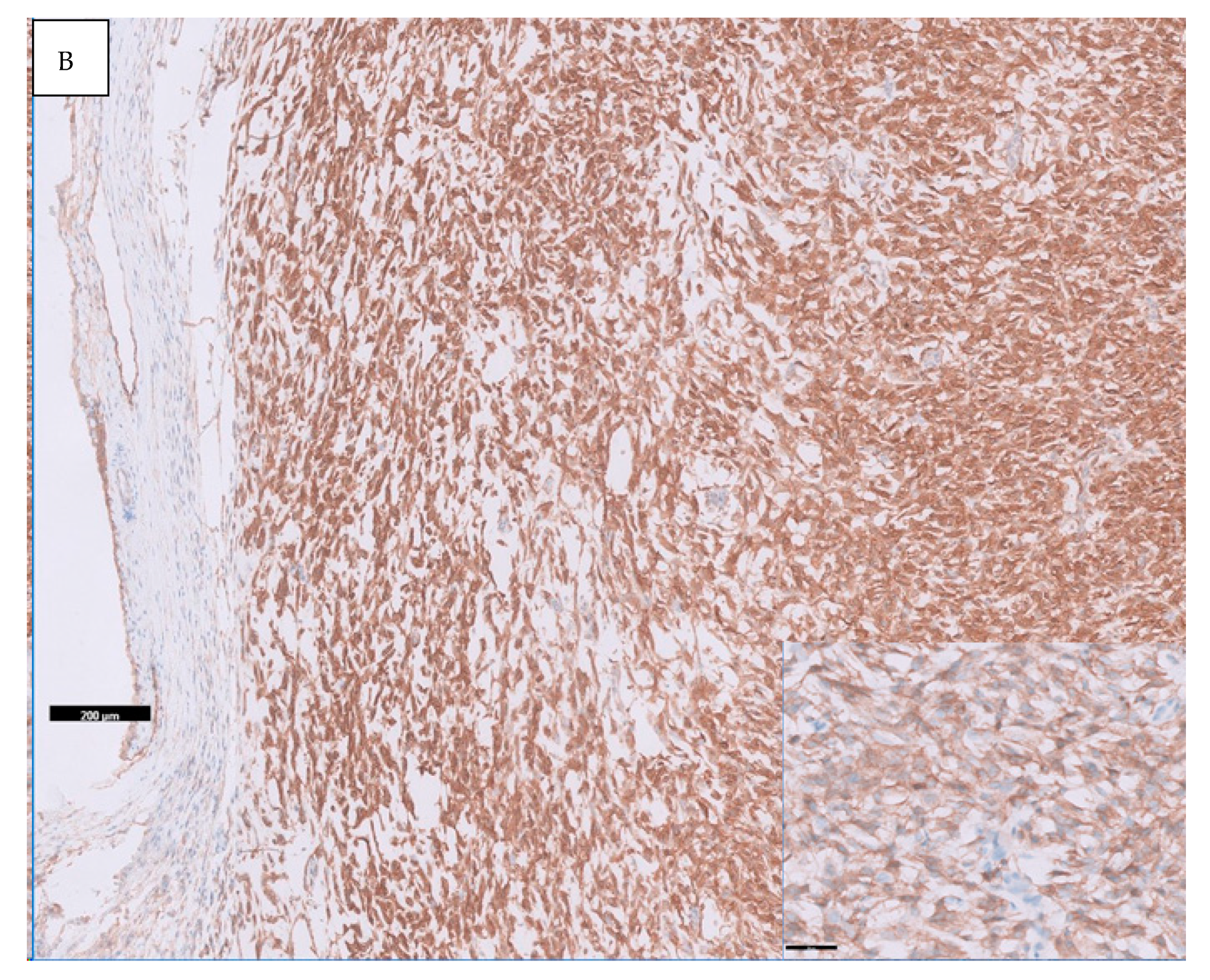 Diagnostics 11 00478 g001b Diagnostics 11 00478 g001b