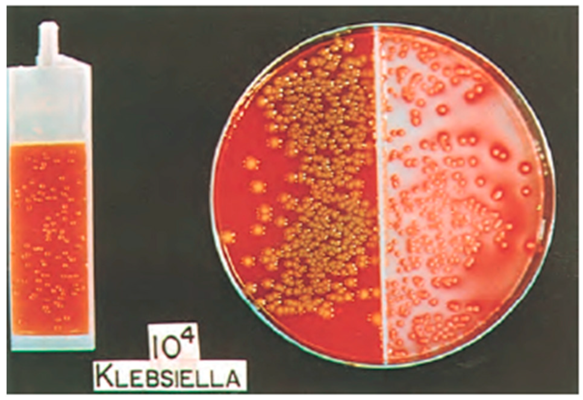Высокие бактерии в моче. Морганелла микробиология. Бактерии в моче. Морганелла моргании в моче. Моча на АГ стрептококка.