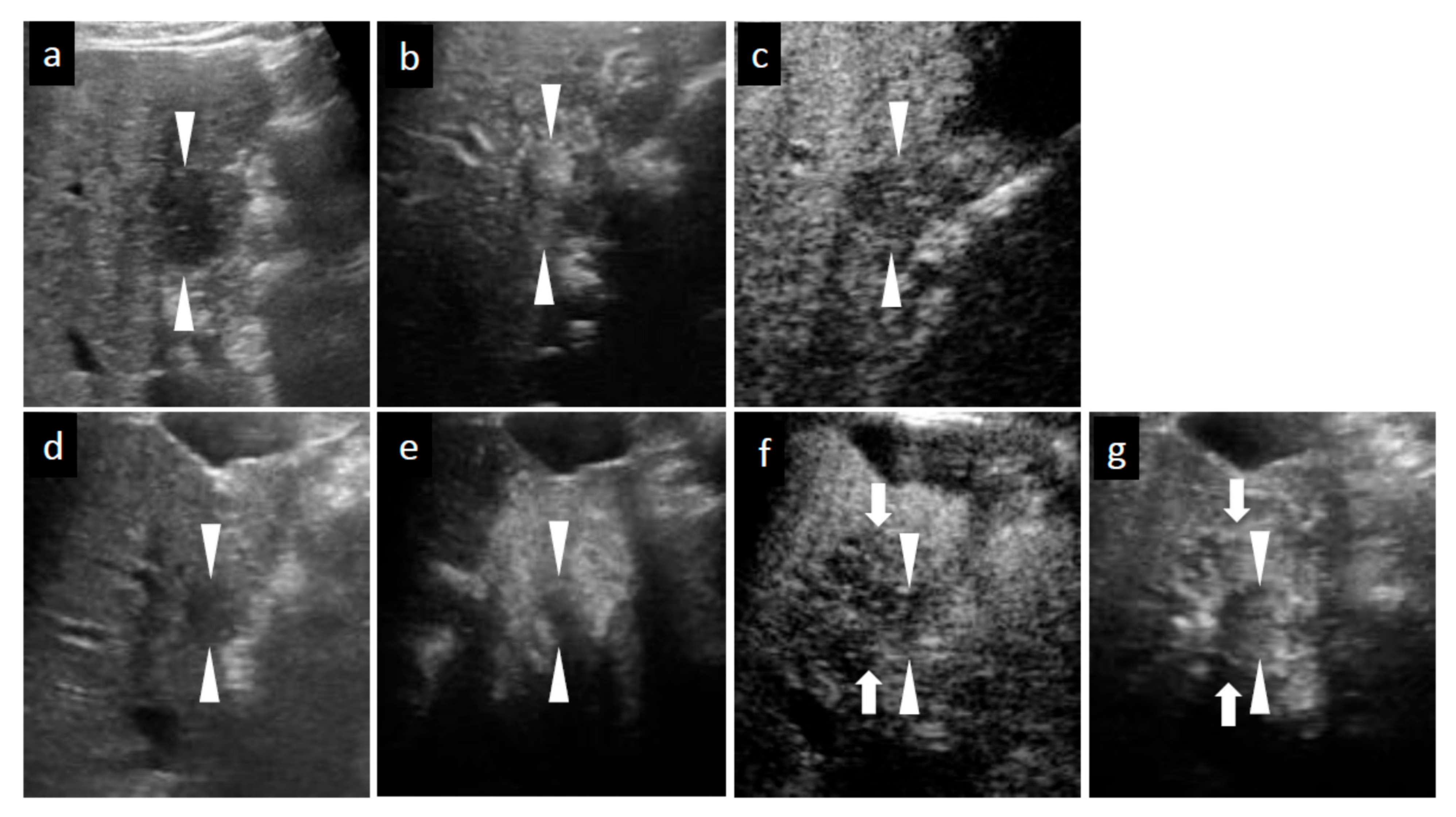 Diagnostics 11 00486 g002a