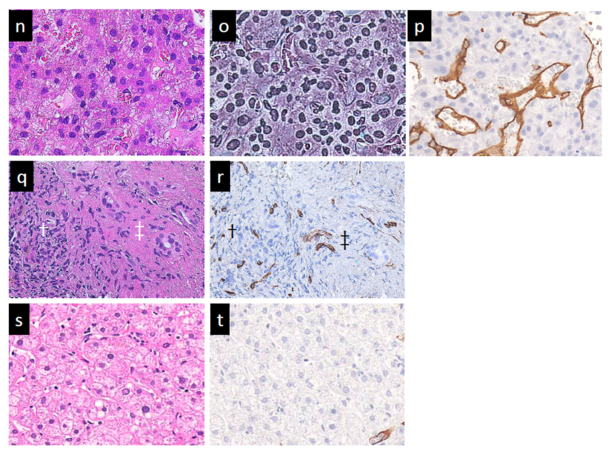 Diagnostics 11 00486 g003b