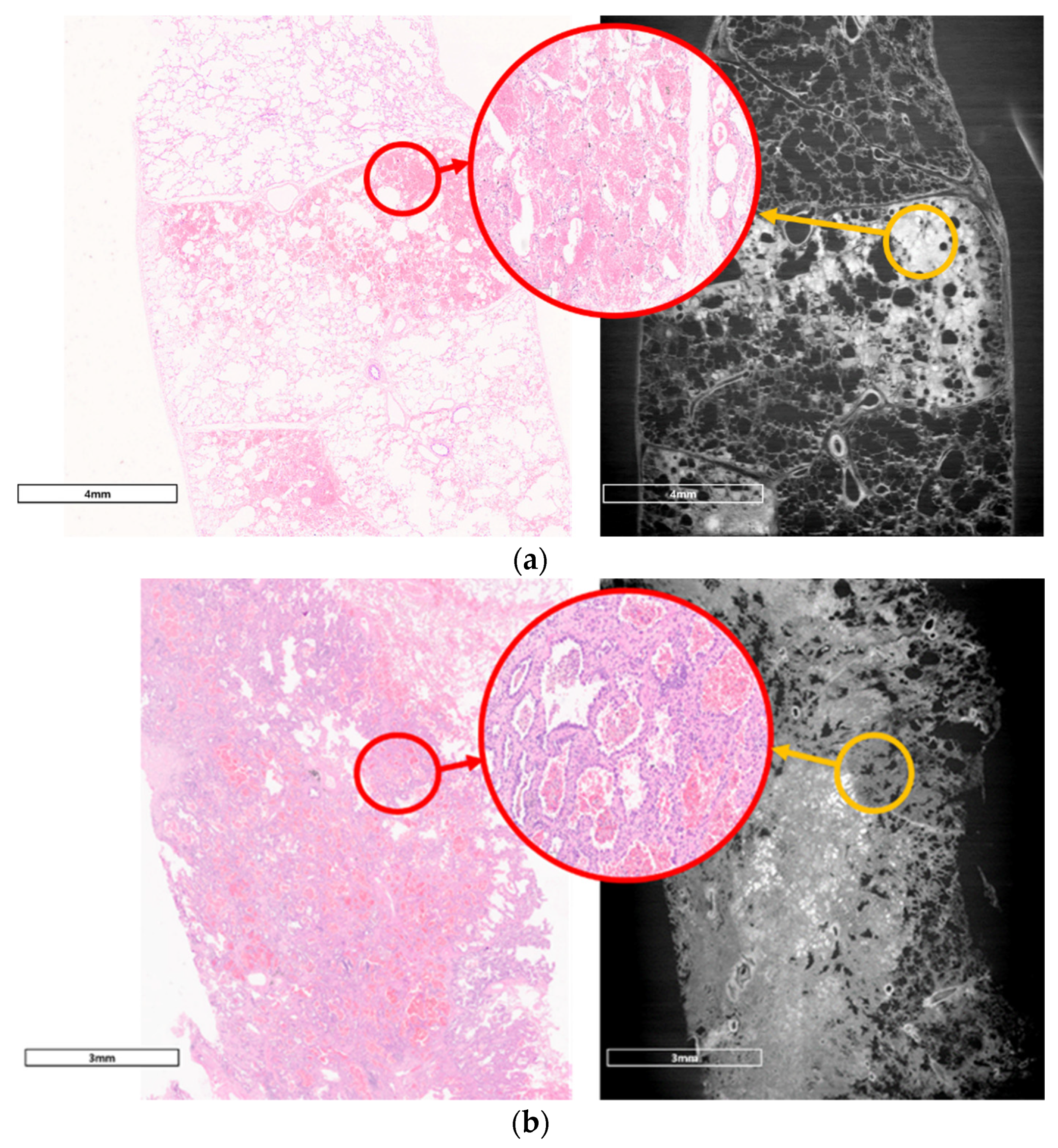 Diagnostics 11 00487 g005
