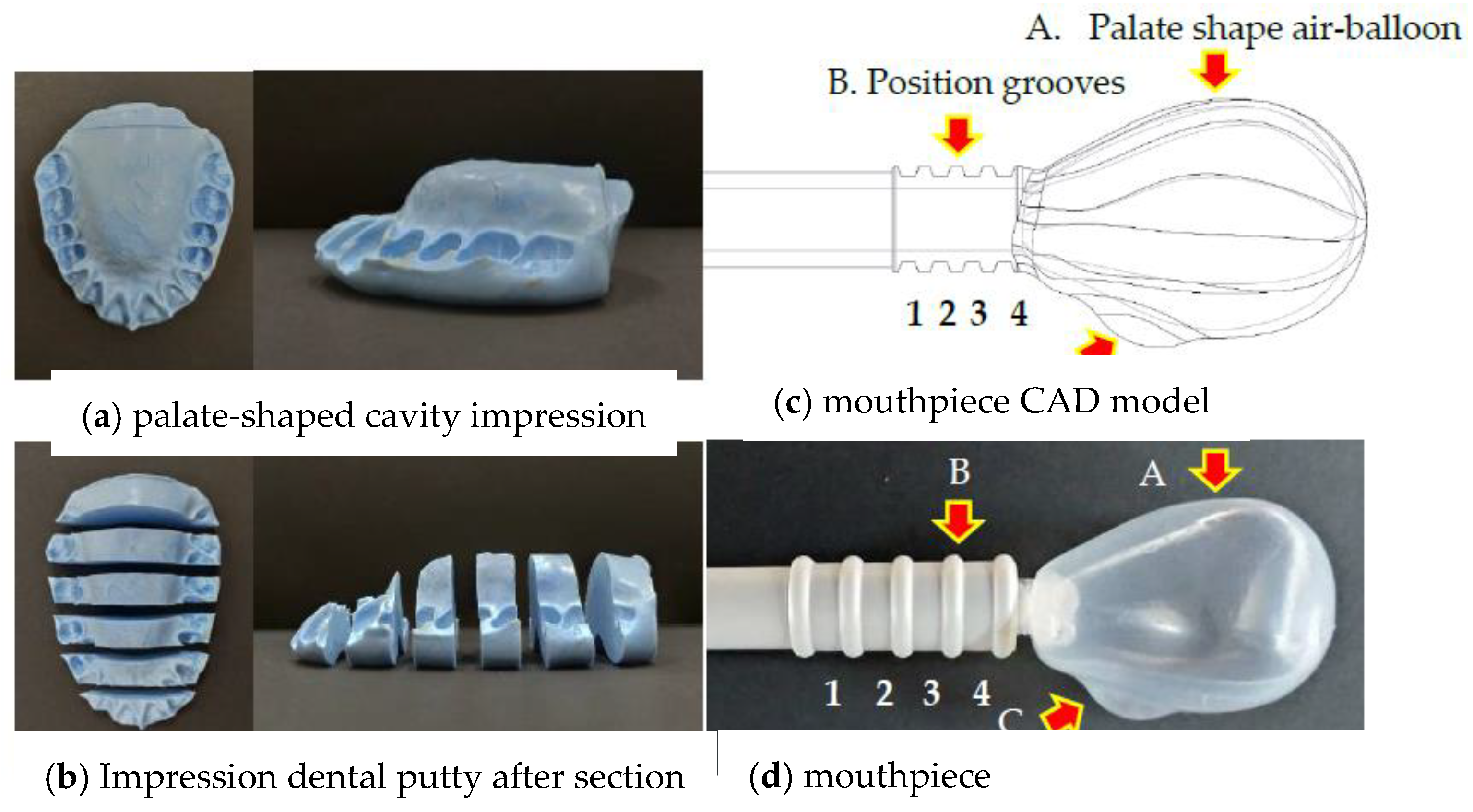 Diagnostics Free FullText A Novel Tongue Pressure Measurement