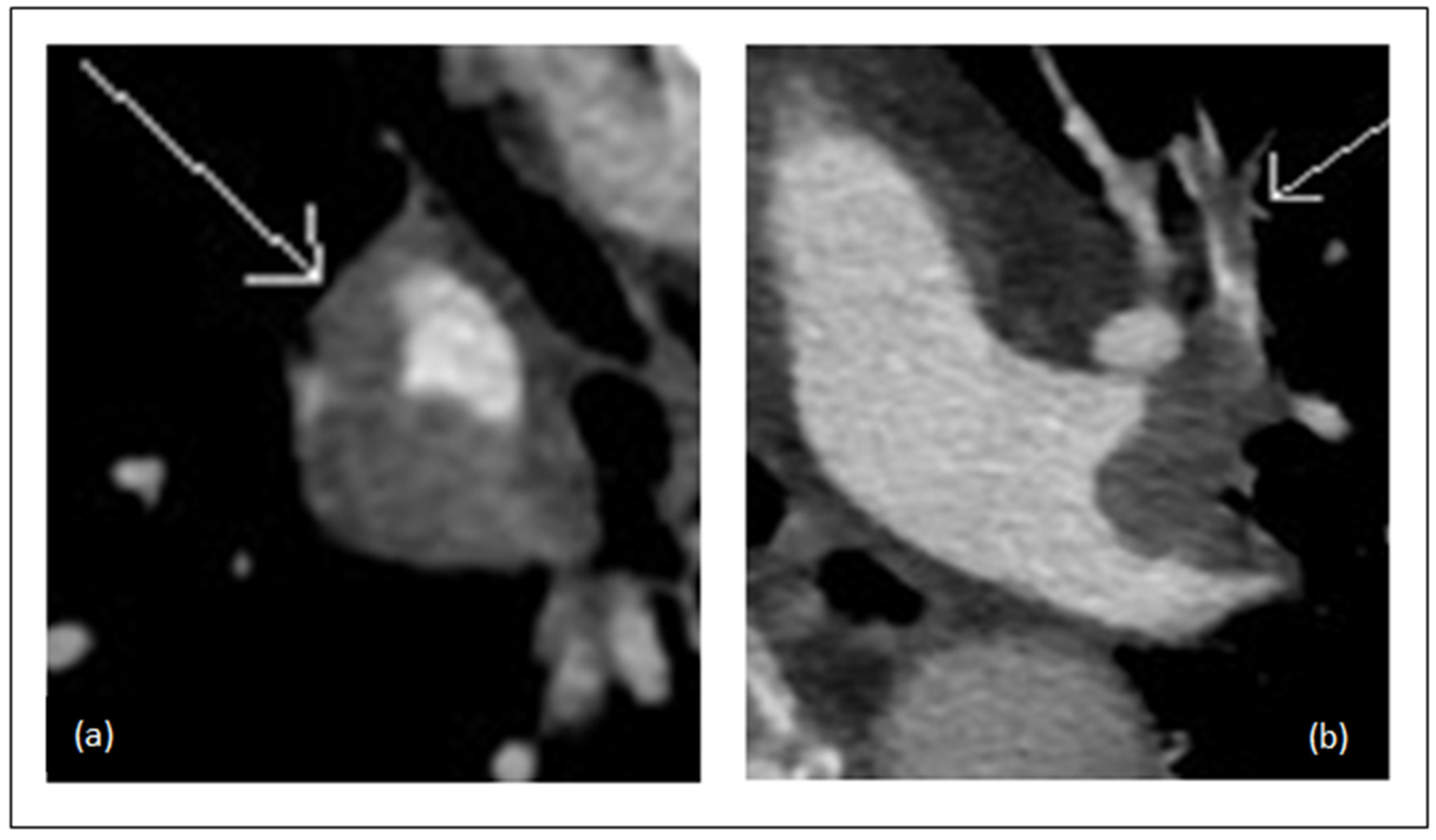 Diagnostics 11 00495 g002 Diagnostics 11 00495 g002