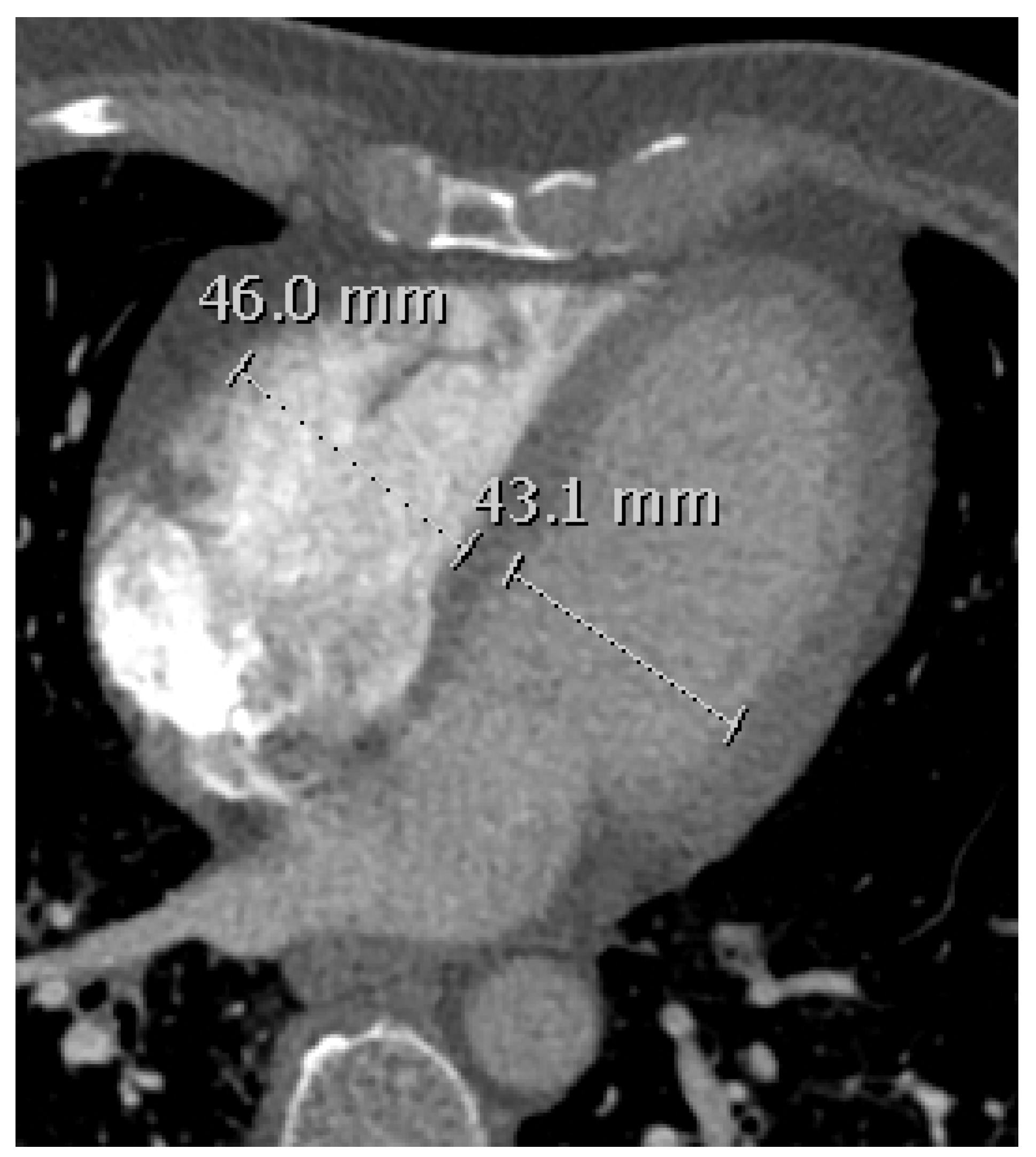 Diagnostics 11 00495 g003 Diagnostics 11 00495 g003