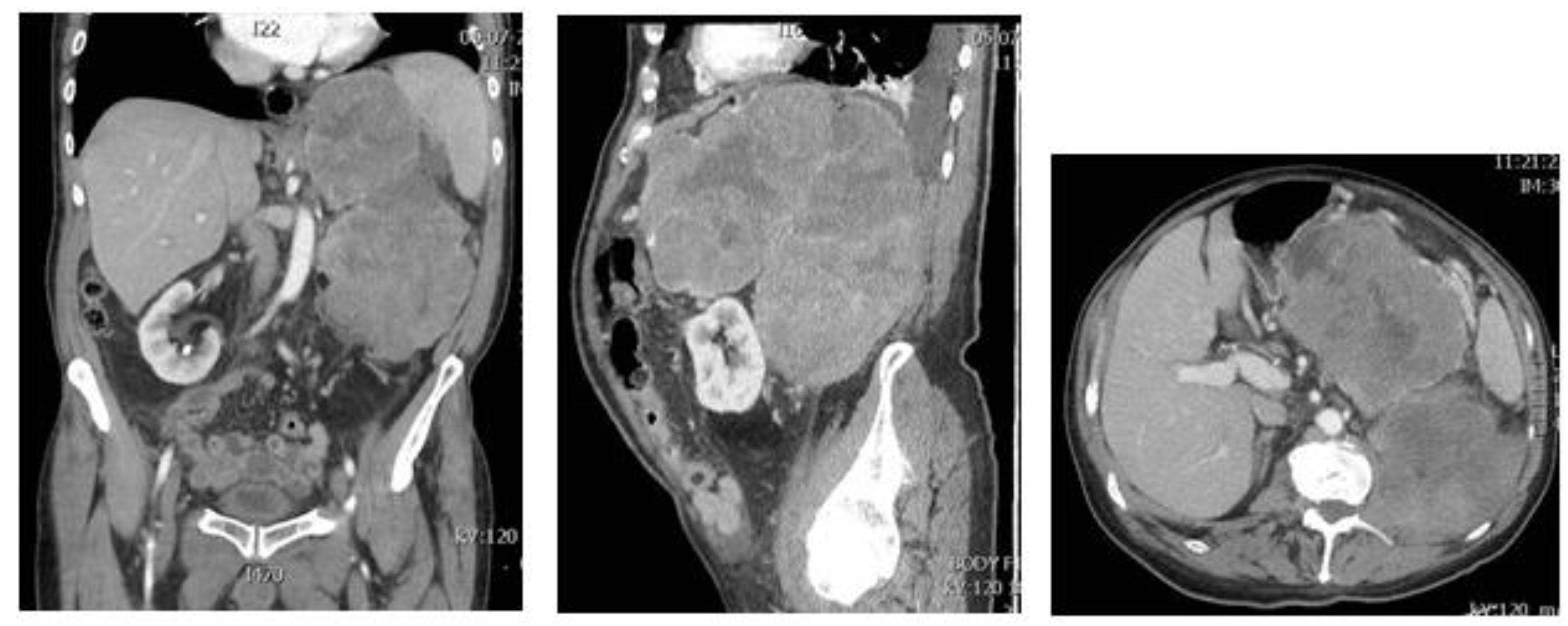 Diagnostics 11 00496 g006 Diagnostics 11 00496 g006