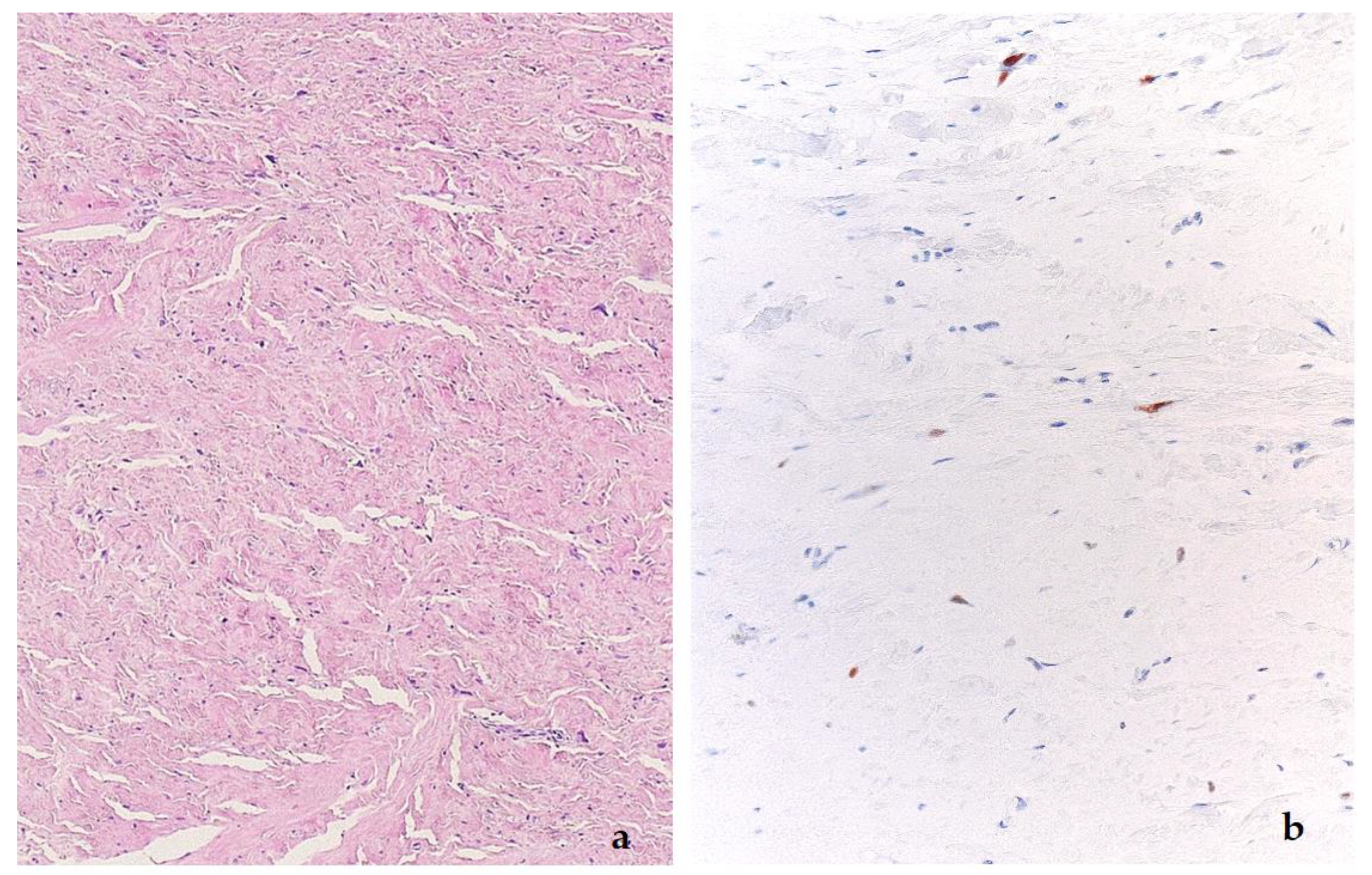 Diagnostics 11 00496 g008 Diagnostics 11 00496 g008