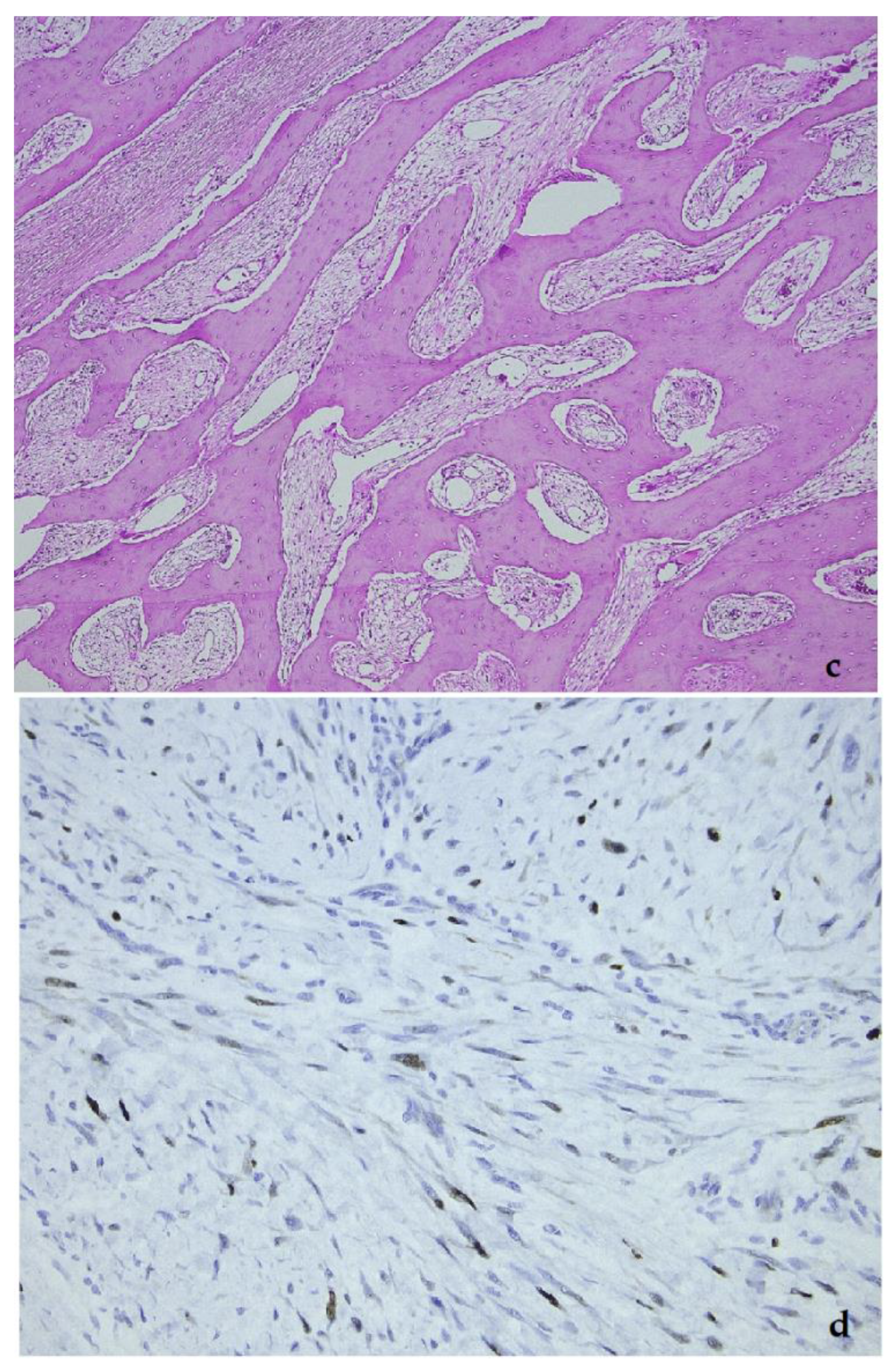 Diagnostics 11 00496 g011b Diagnostics 11 00496 g011b