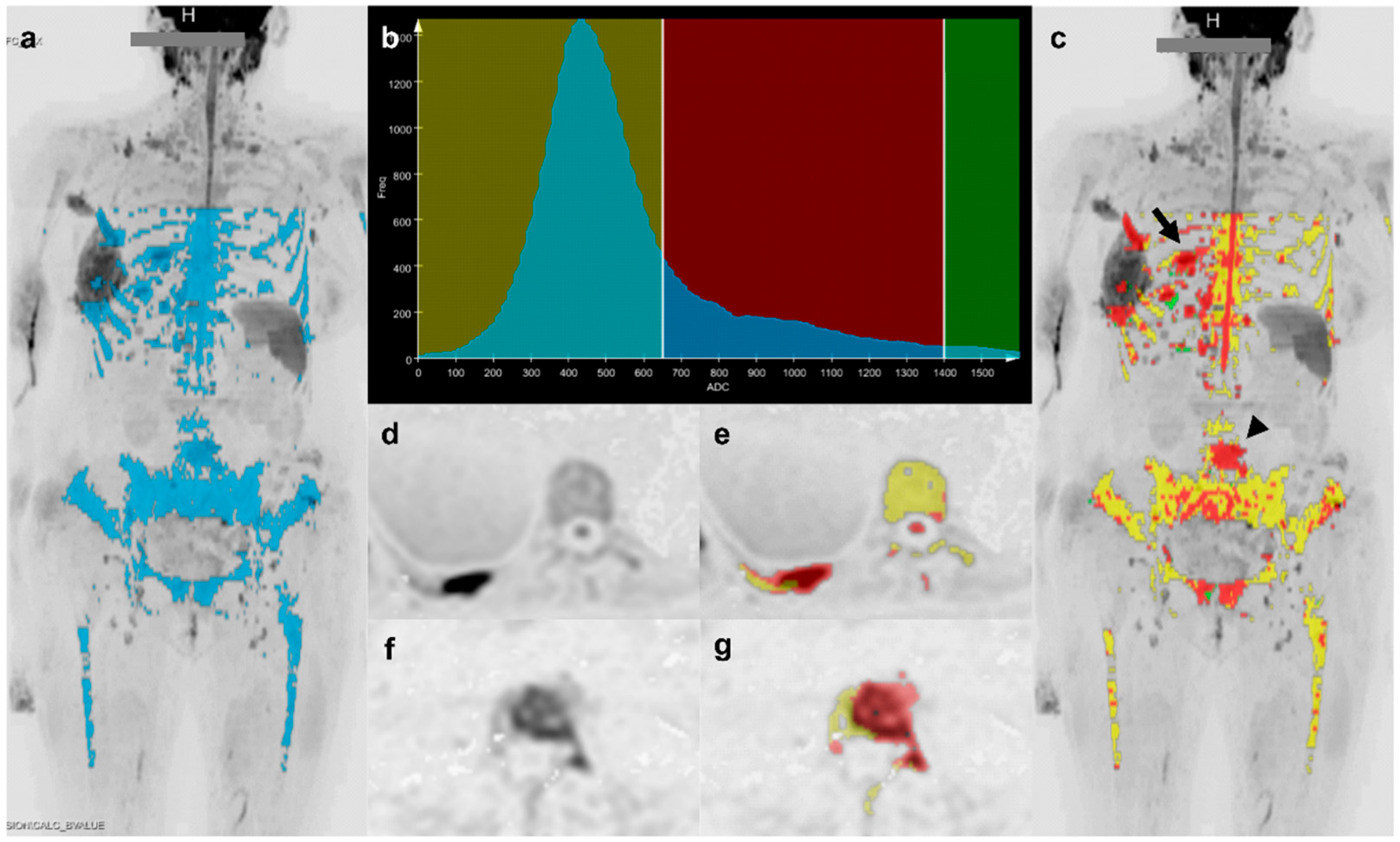 Diagnostics 11 00499 g002 Diagnostics 11 00499 g002