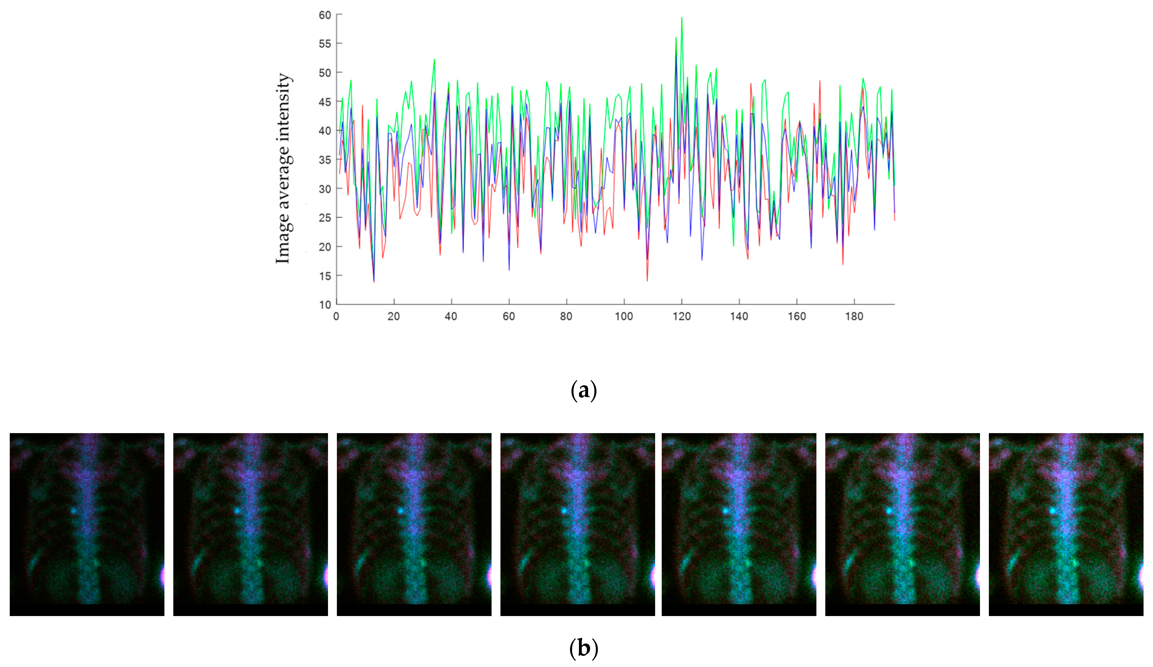 Diagnostics 11 00518 g004