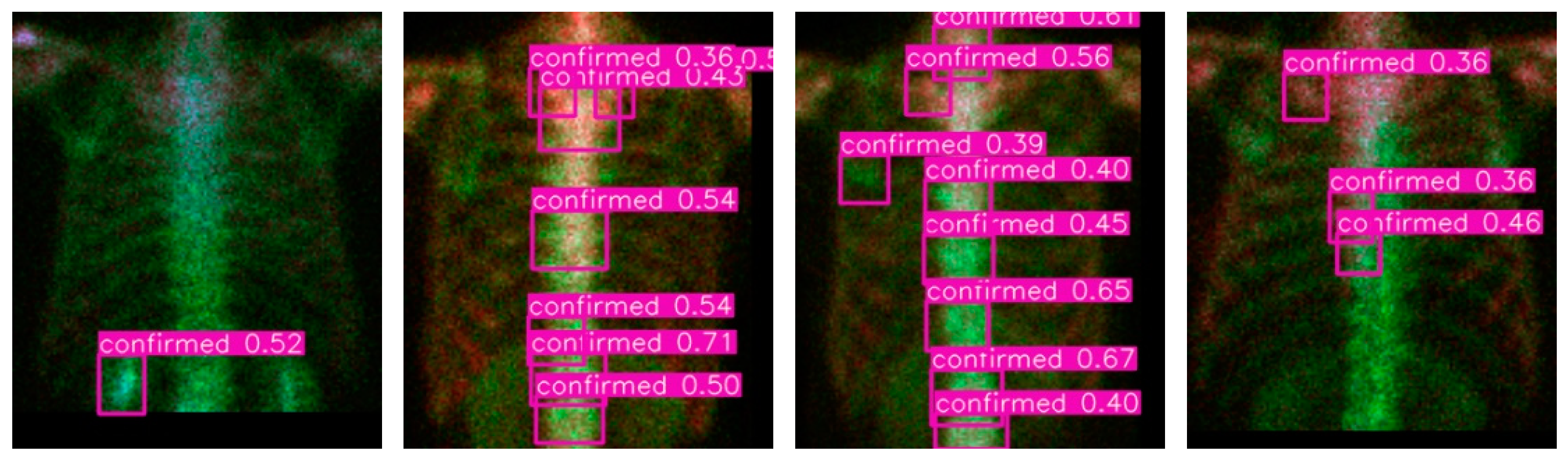 Diagnostics 11 00518 g009