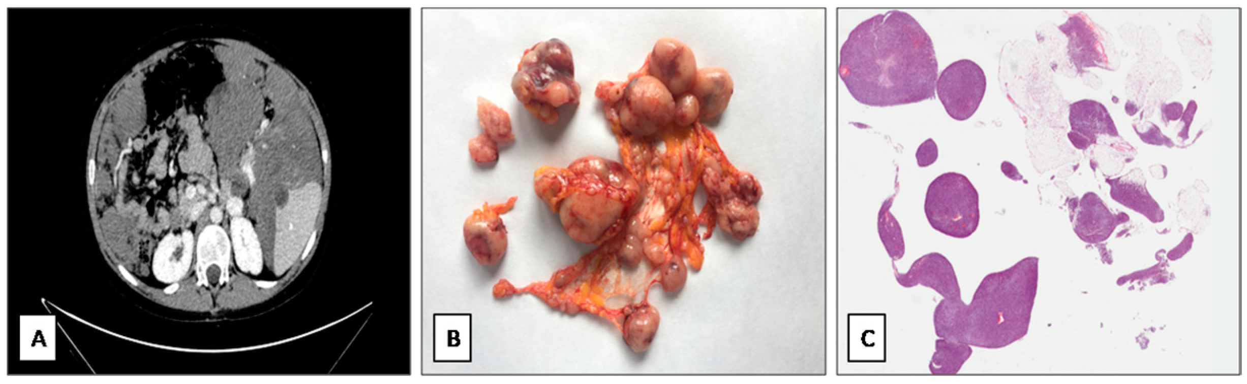 Diagnostics 11 00545 g001 Diagnostics 11 00545 g001