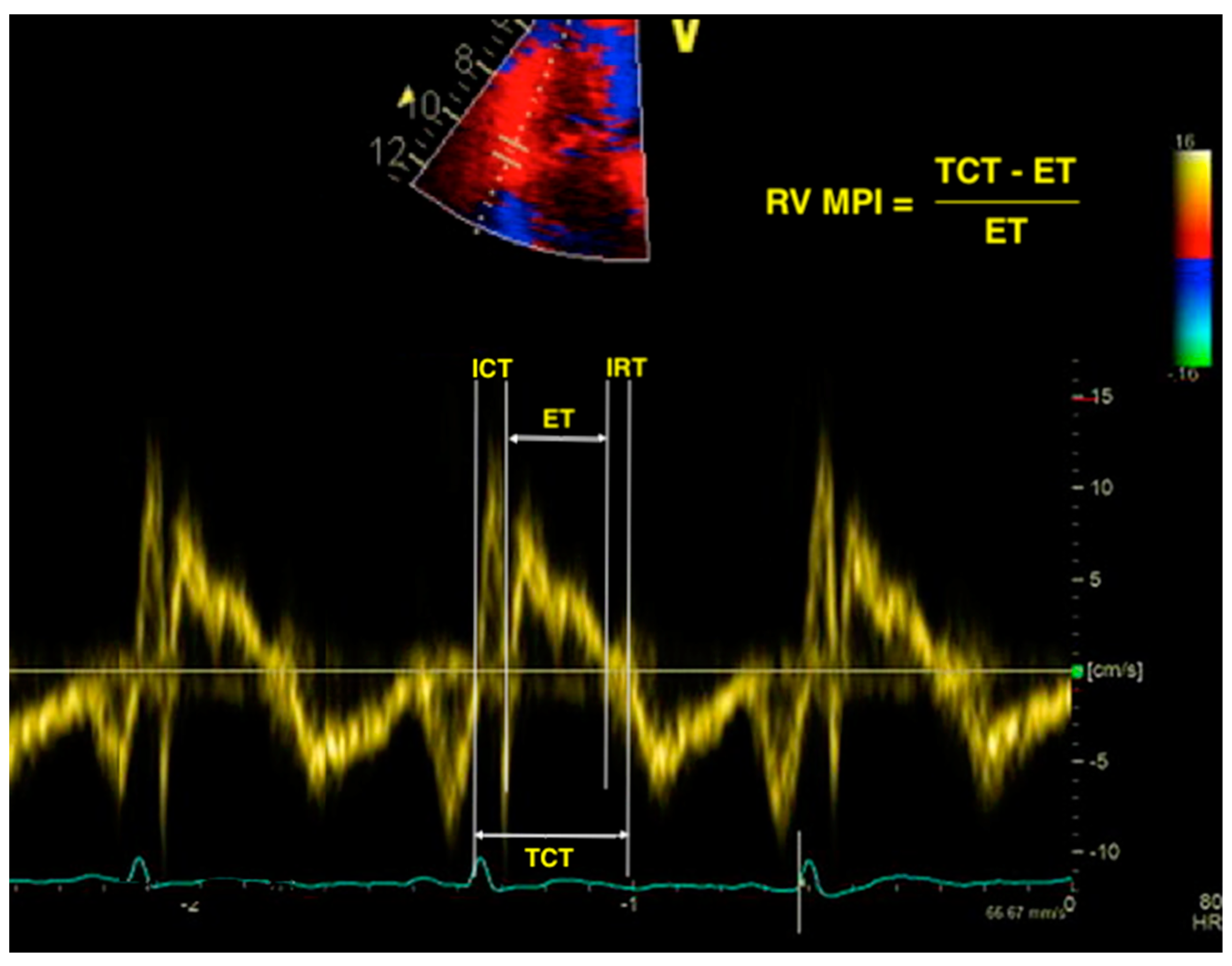 Diagnostics Free FullText No More—The Role of Right