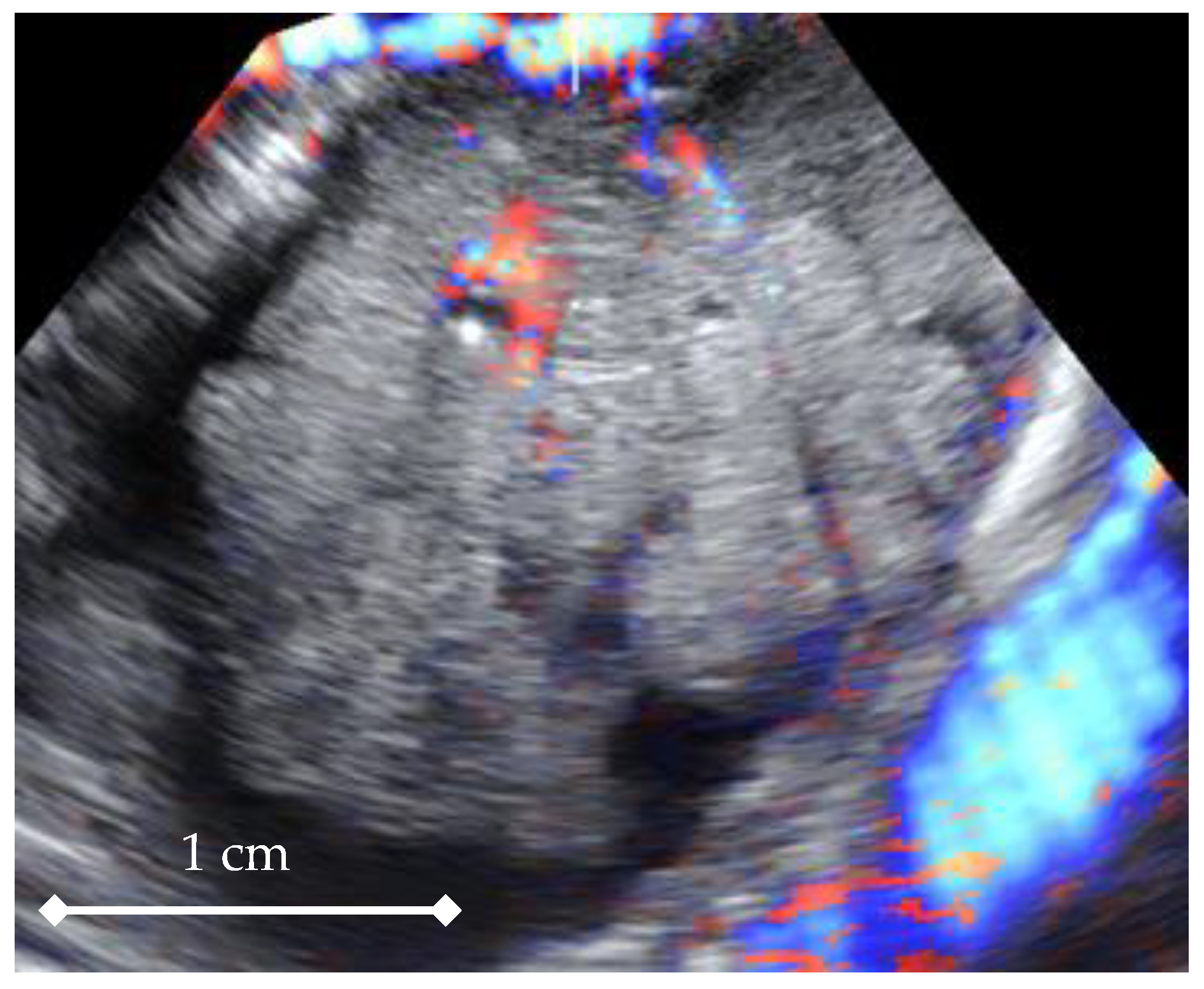 Diagnostics 11 00582 g003 Diagnostics 11 00582 g003