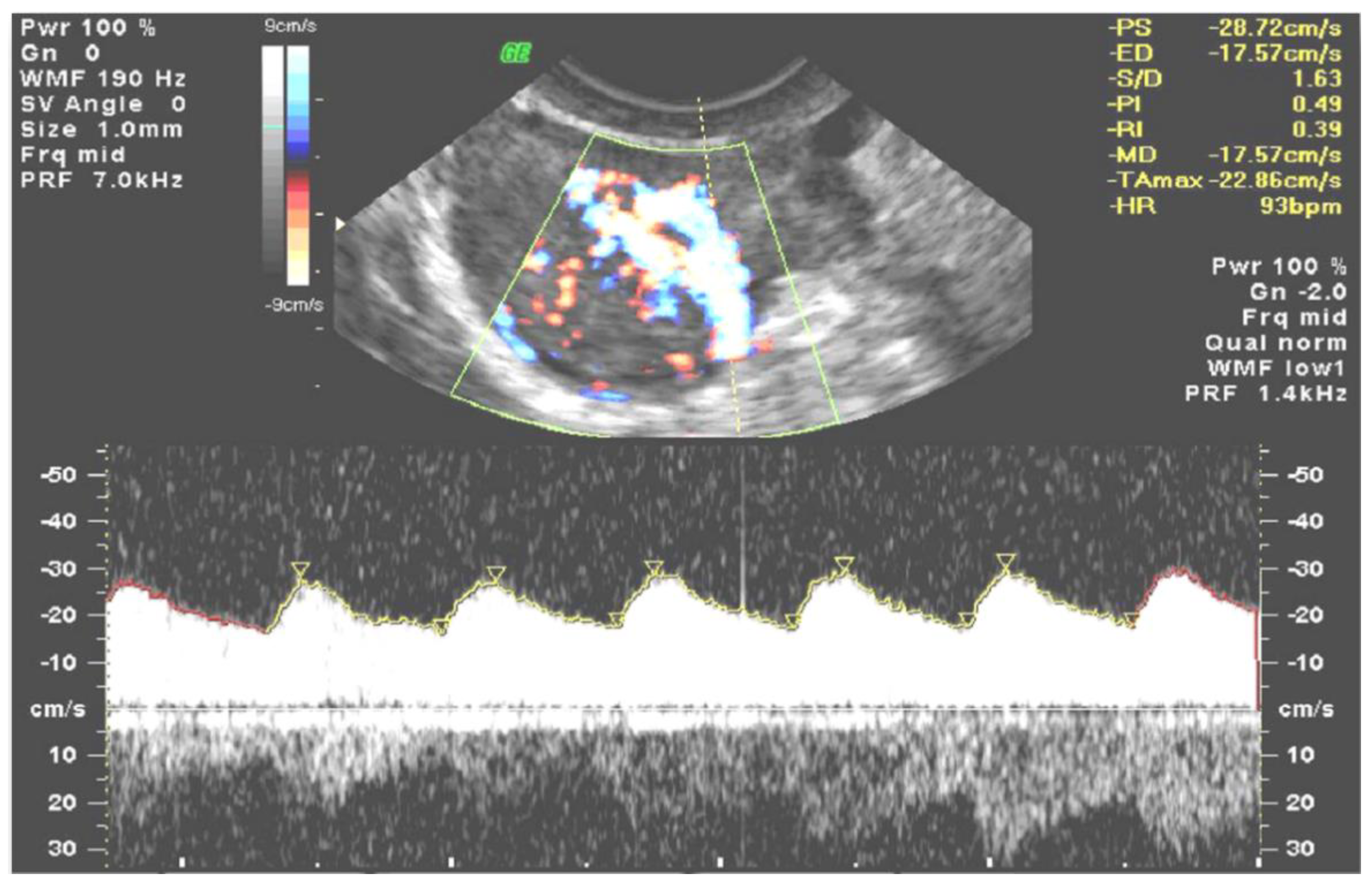 Diagnostics 11 00582 g009 Diagnostics 11 00582 g009
