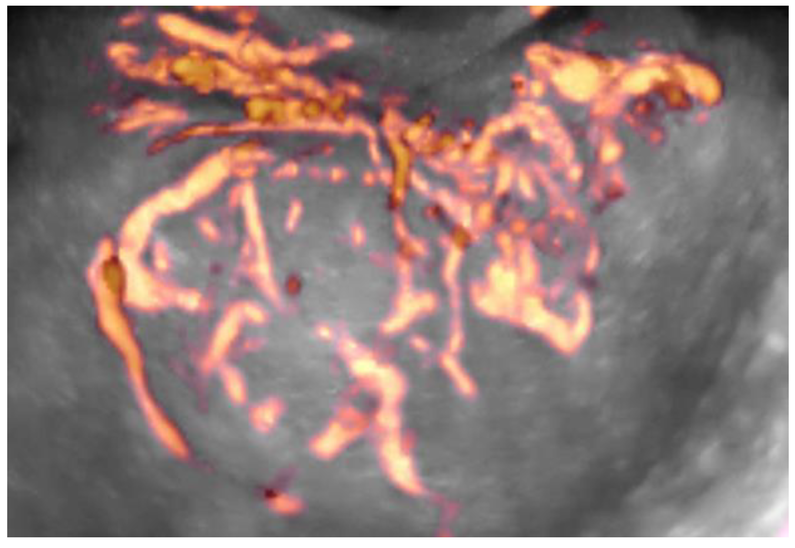 Diagnostics 11 00582 g010 Diagnostics 11 00582 g010