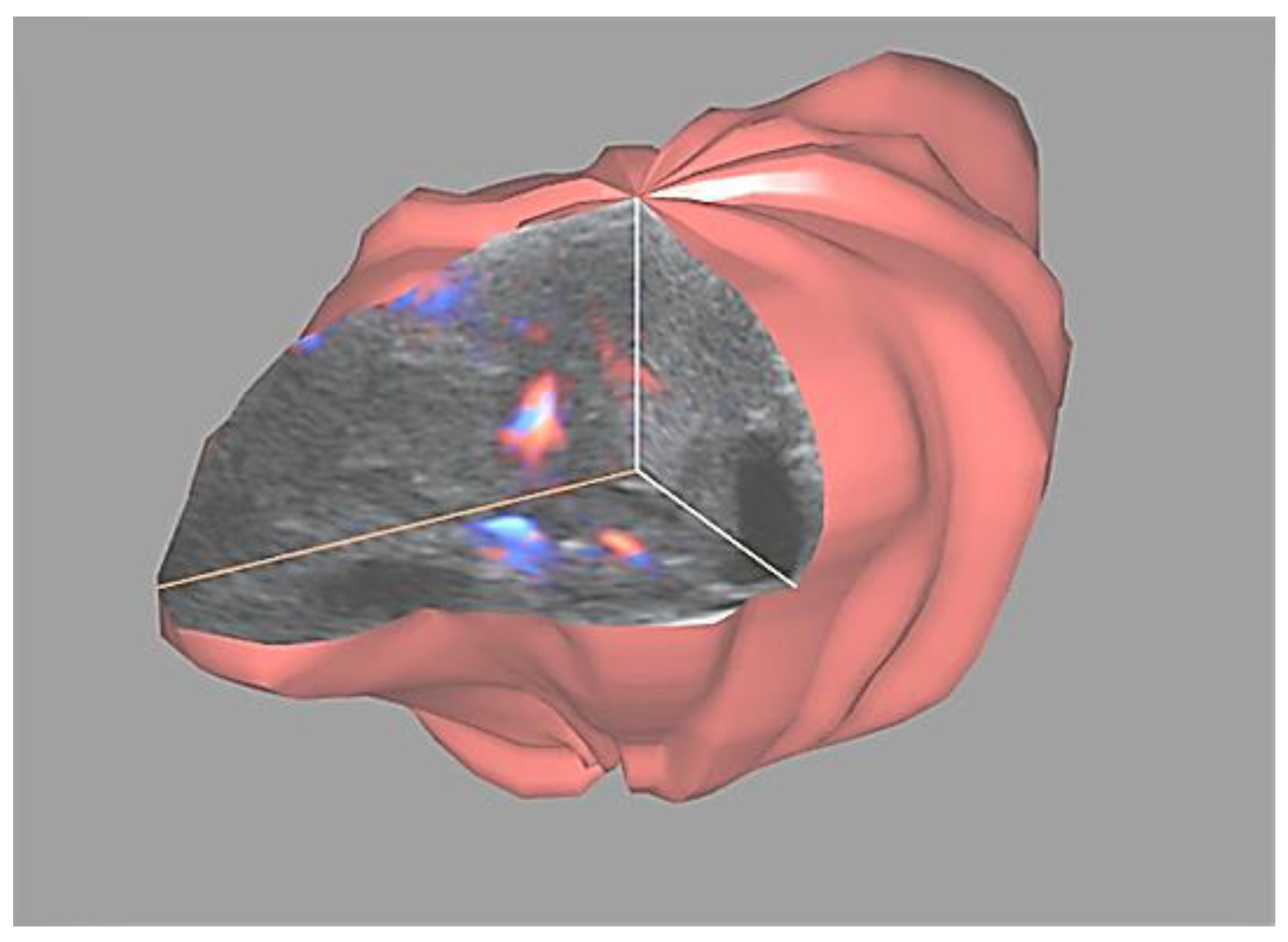 Diagnostics 11 00582 g011 Diagnostics 11 00582 g011