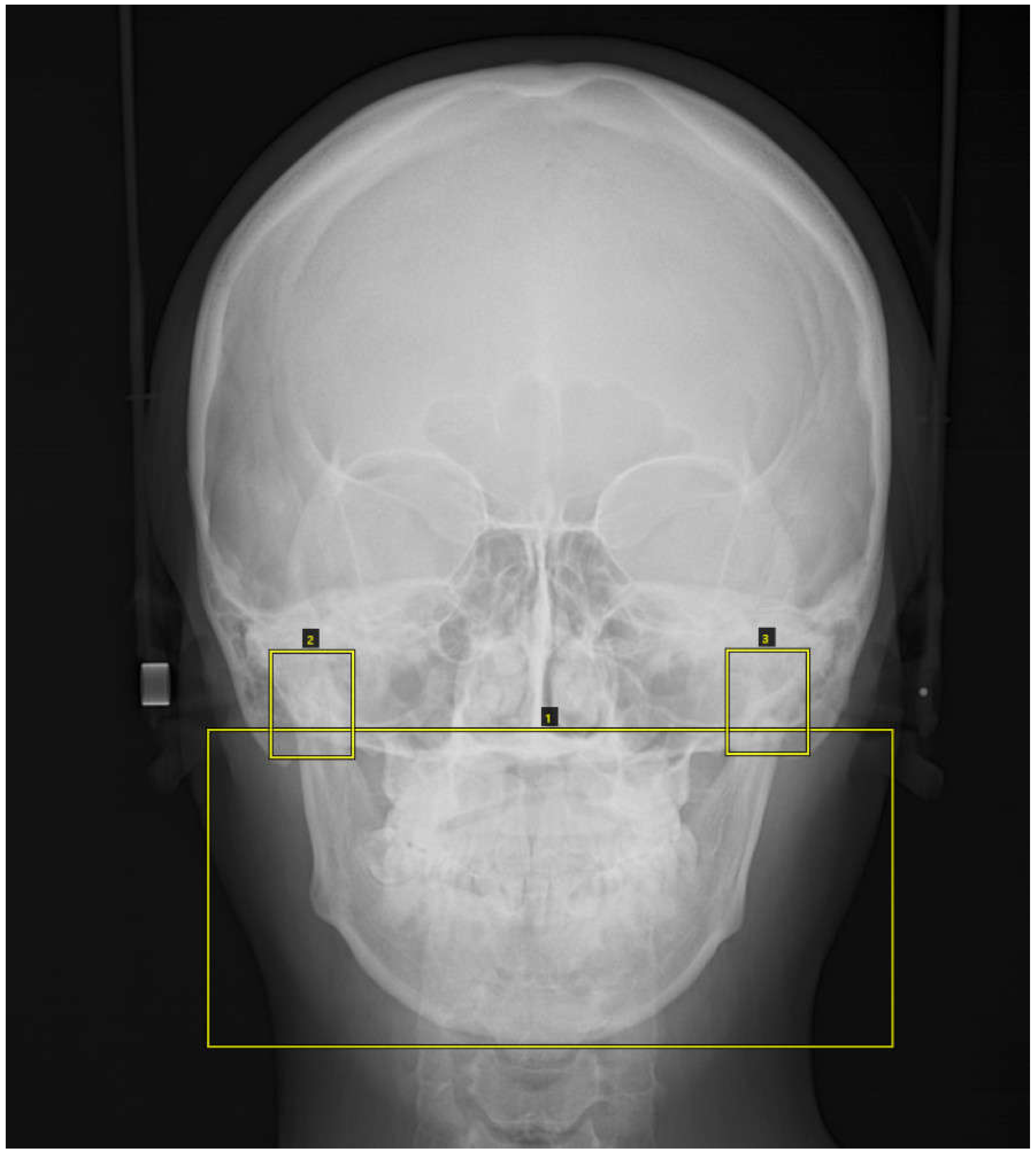 Diagnostics Free Full Text Deep Learning Based Detection Of Cranio Spinal Differences Between Skeletal Classification Using Cephalometric Radiography Html