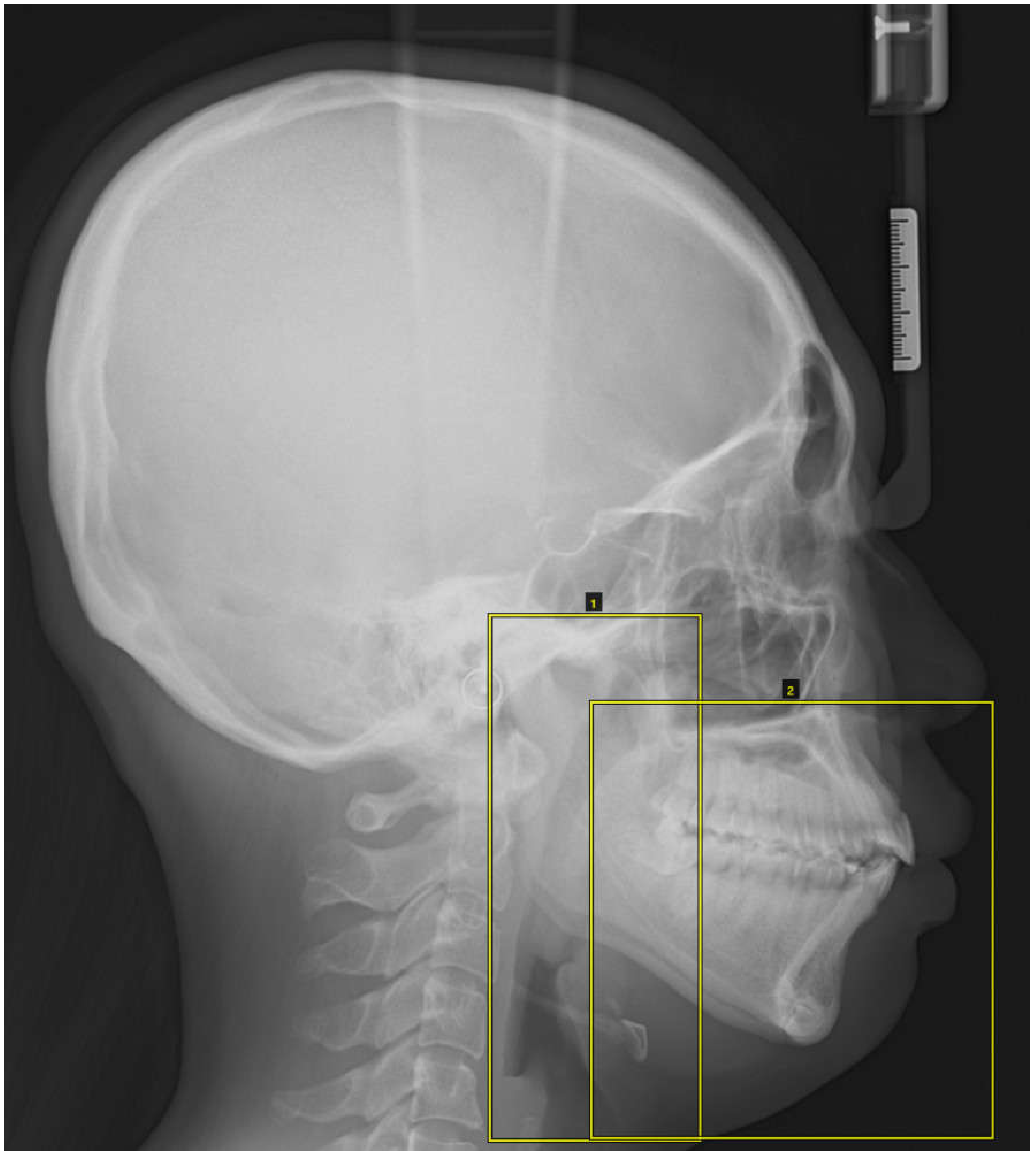 Diagnostics Free Full Text Deep Learning Based Detection Of Cranio Spinal Differences Between Skeletal Classification Using Cephalometric Radiography Html Diagnostics Free Full Text Deep Learning Based Detection Of Cranio Spinal Differences Between Skeletal Classification Using Cephalometric Radiography Html