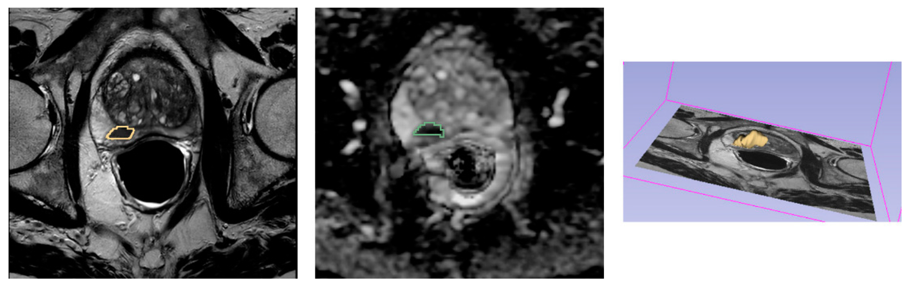 Diagnostics 11 00594 g001