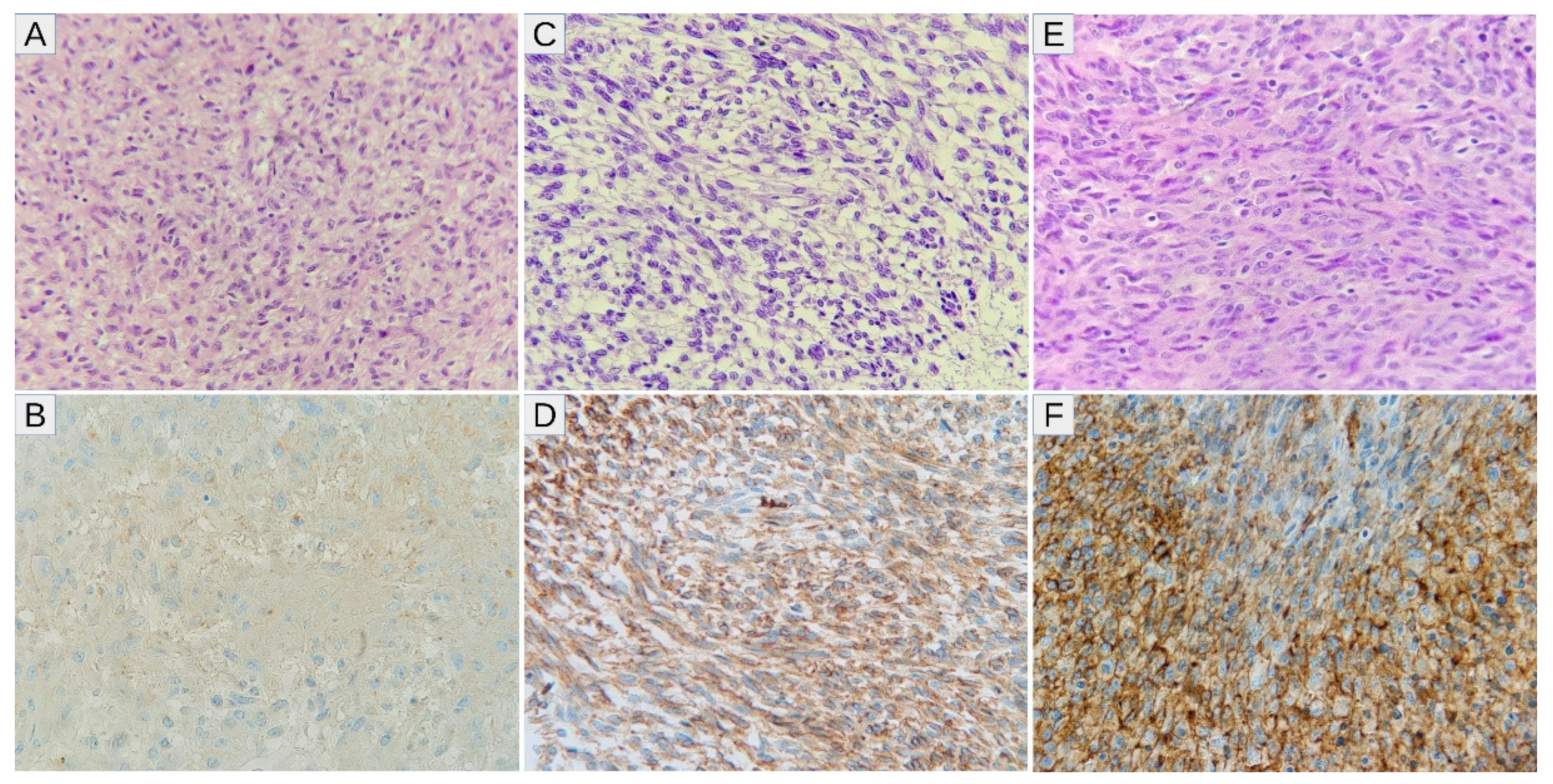 Diagnostics 11 00598 g002 Diagnostics 11 00598 g002