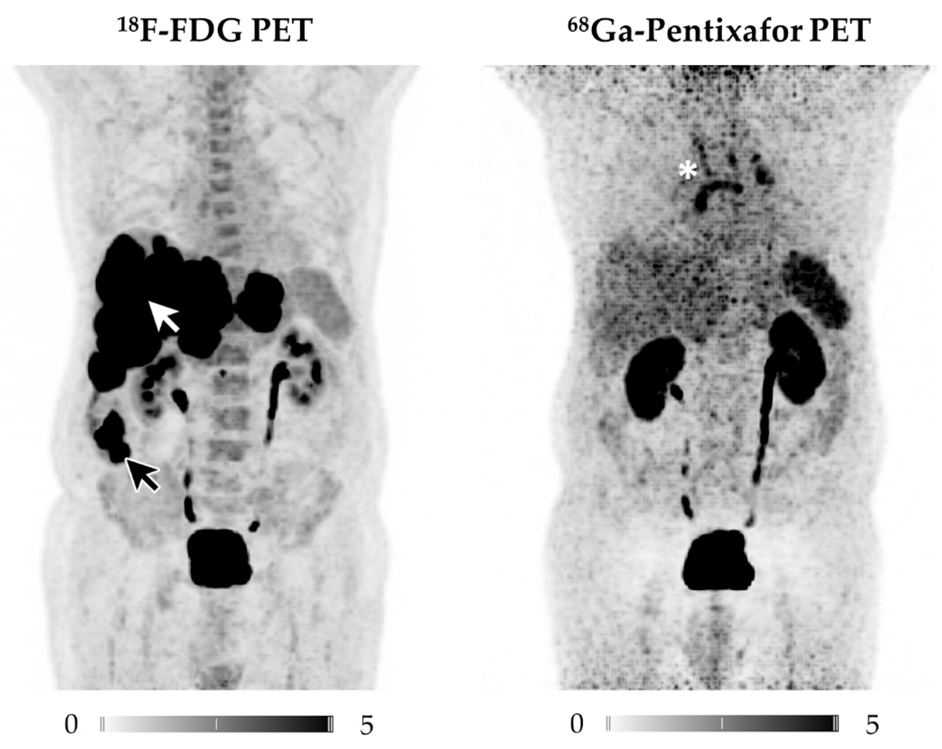 はじめましてのPET/CT はじめましてのPET/CT | 村上 康二, 鳥井原 彰, 岩渕 雄 |本