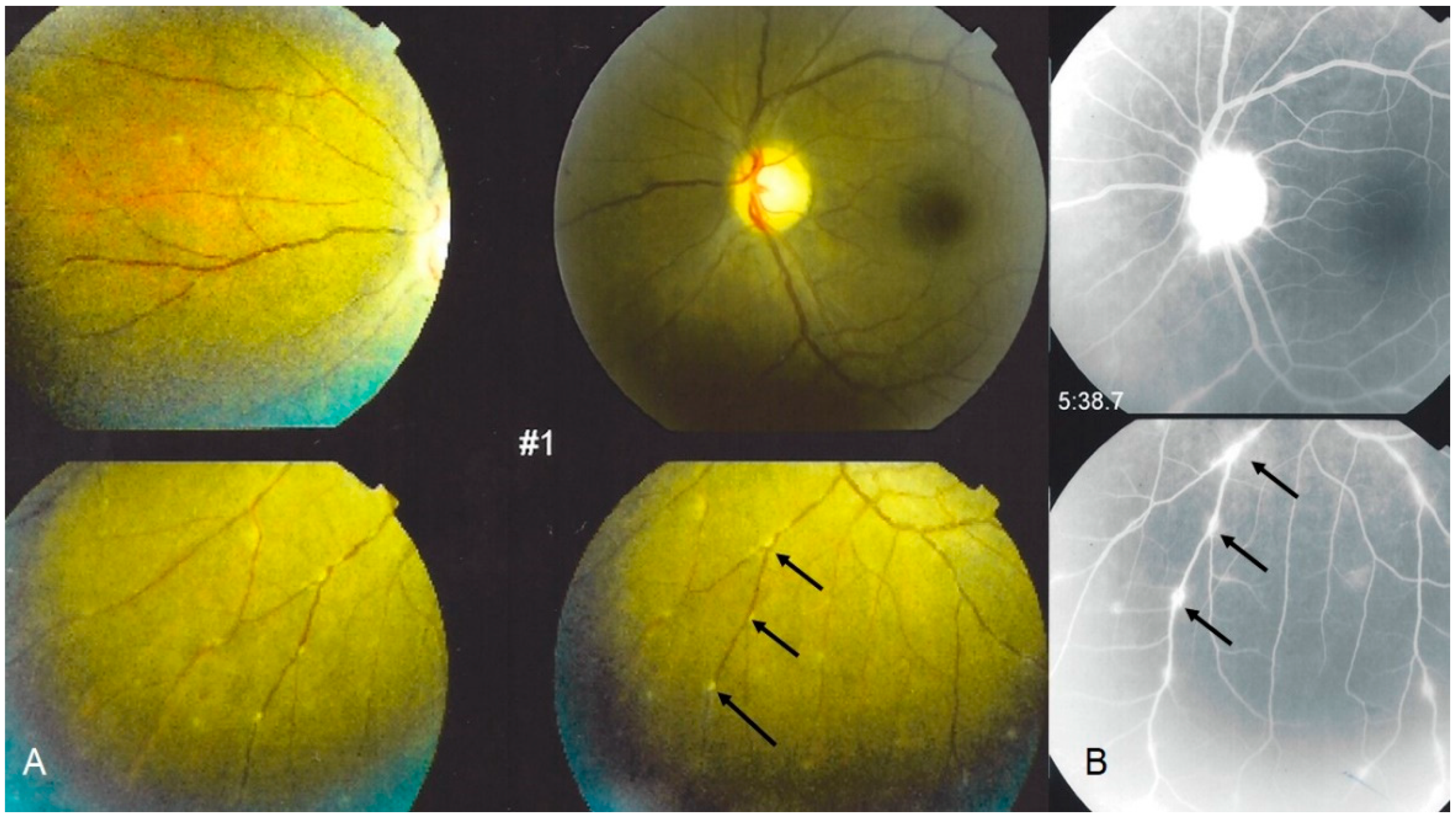 Diagnostics 11 00608 g003 Diagnostics 11 00608 g003