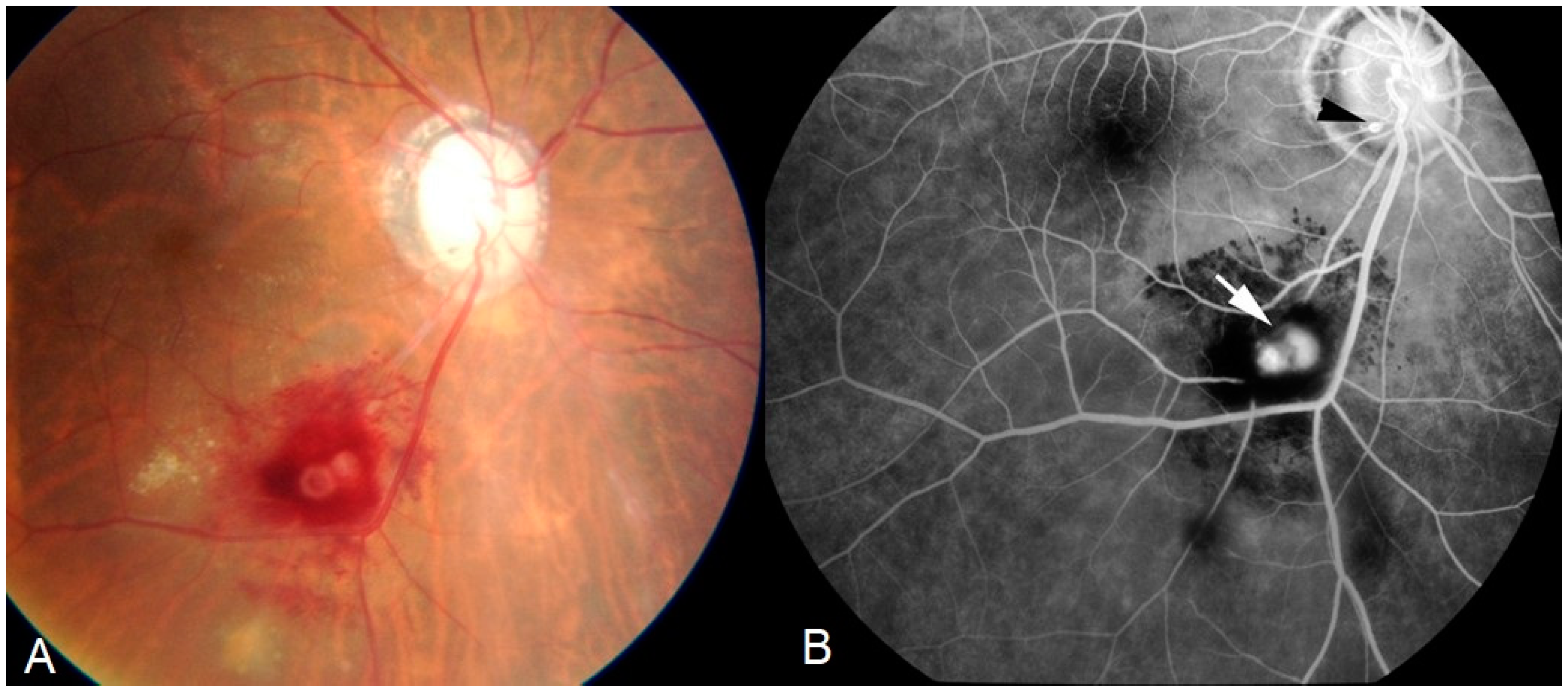 Diagnostics 11 00608 g004 Diagnostics 11 00608 g004