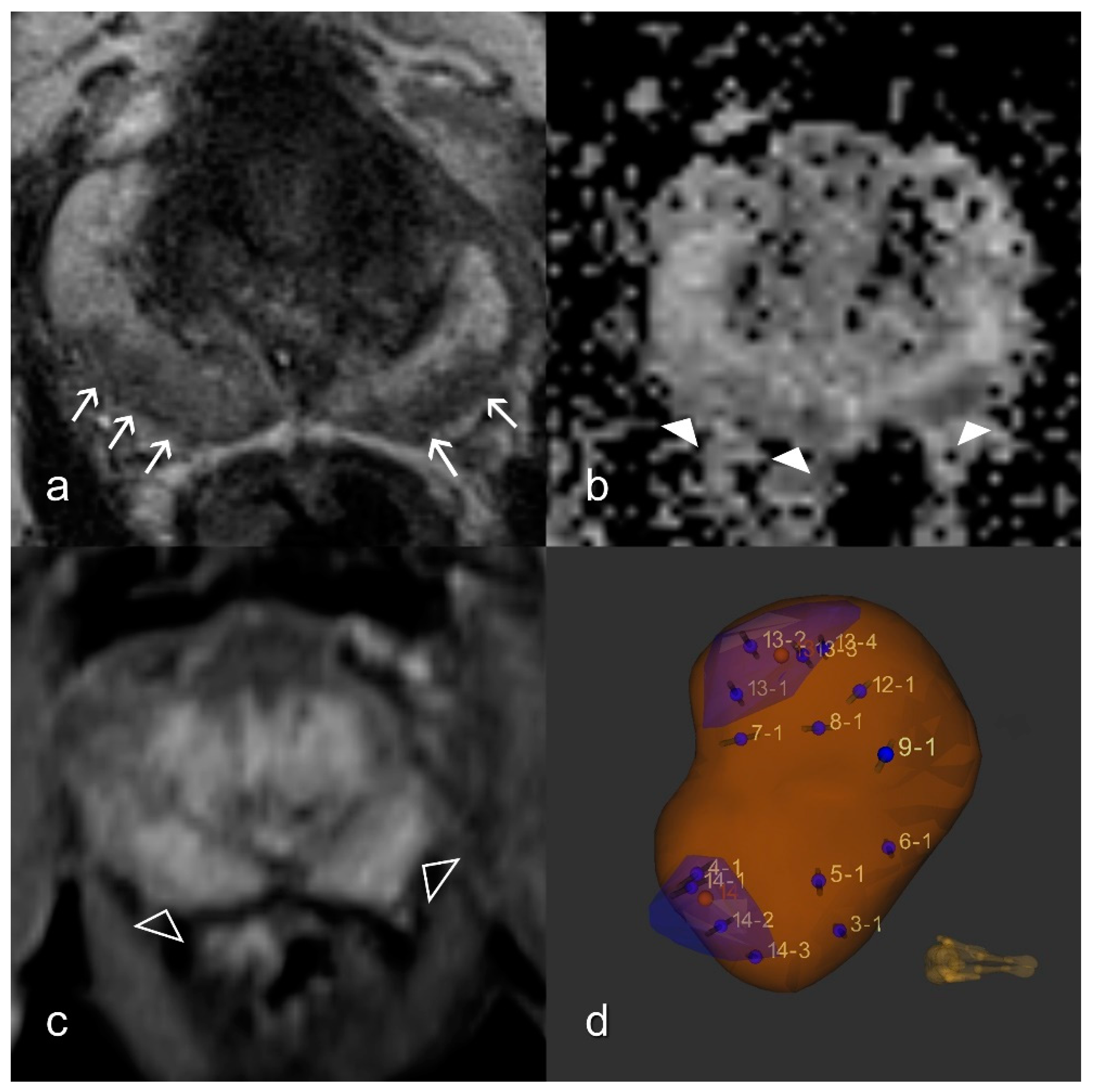 Diagnostics 11 00623 g002