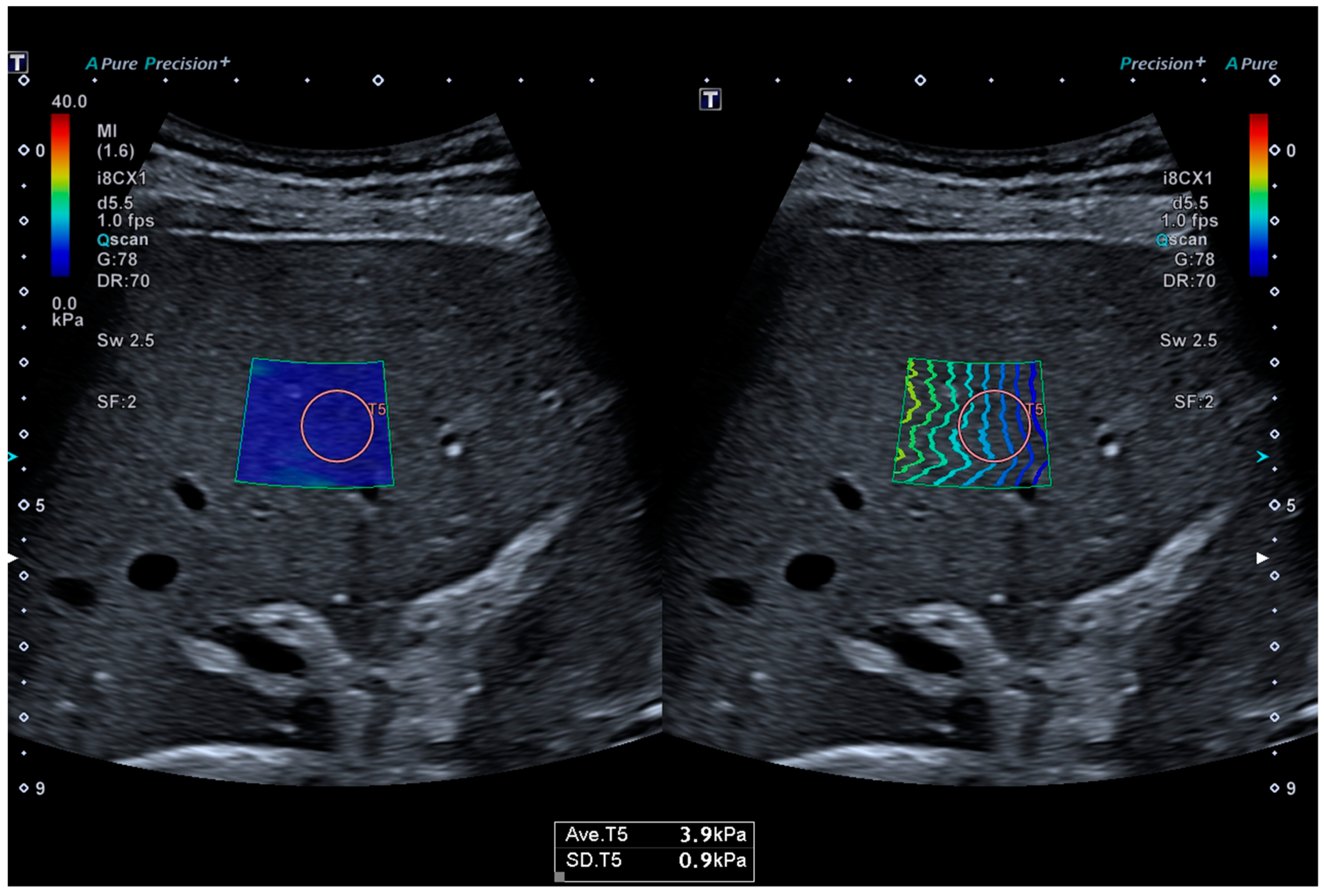 Diagnostics 11 00629 g001