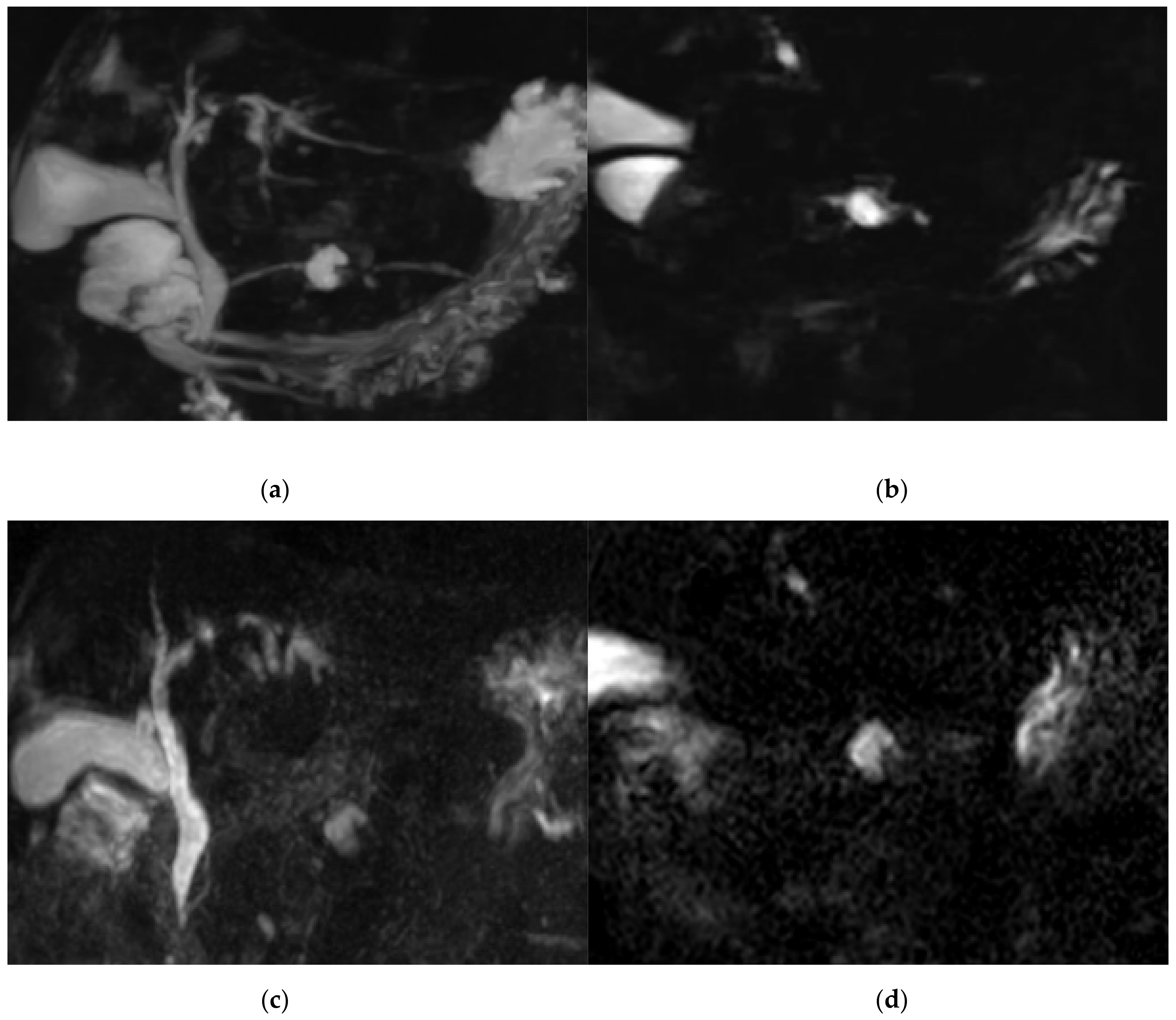 Diagnostics 11 00634 g004 Diagnostics 11 00634 g004